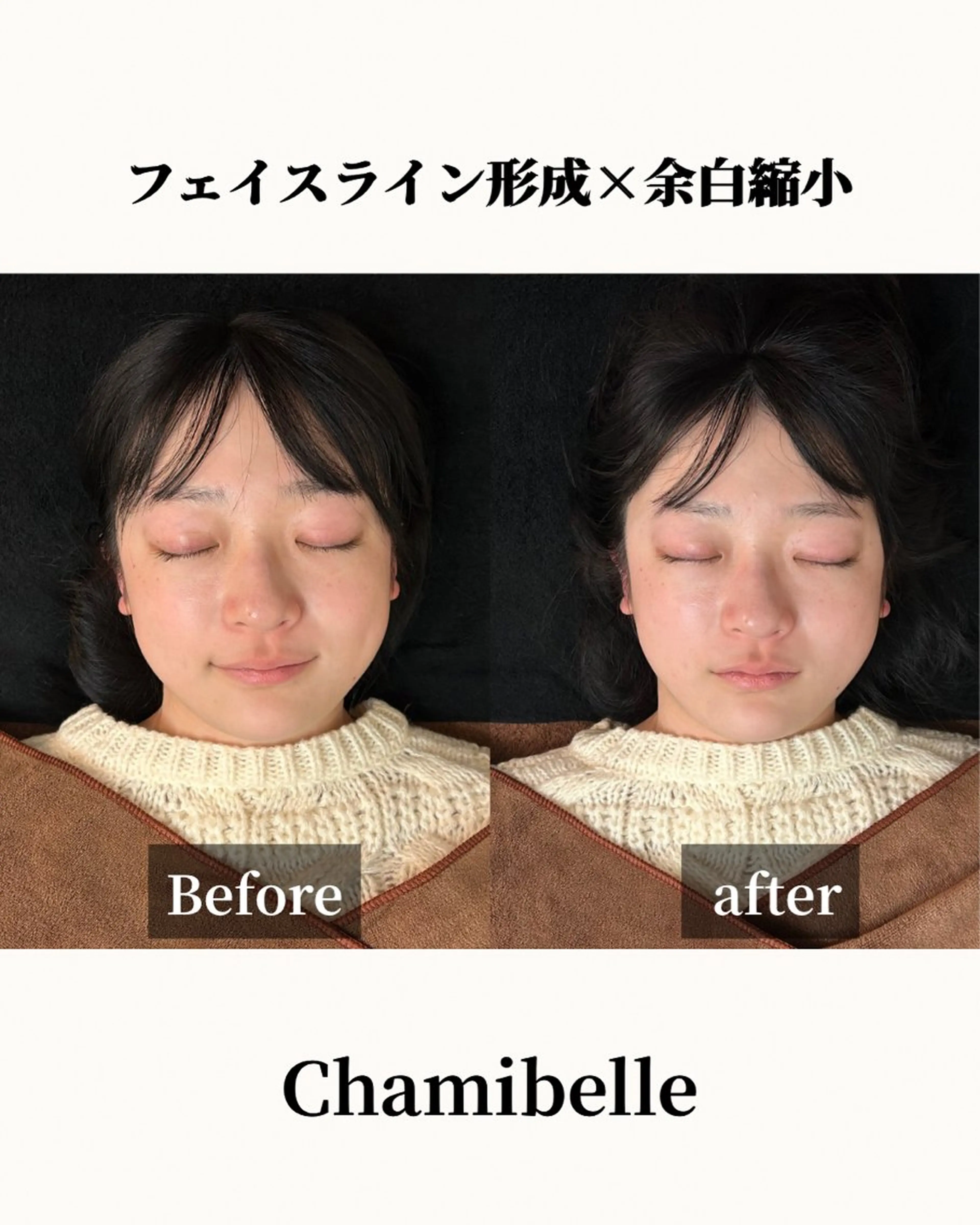 美容鍼灸サロン Chamibelleのエステ・リラクイメージ