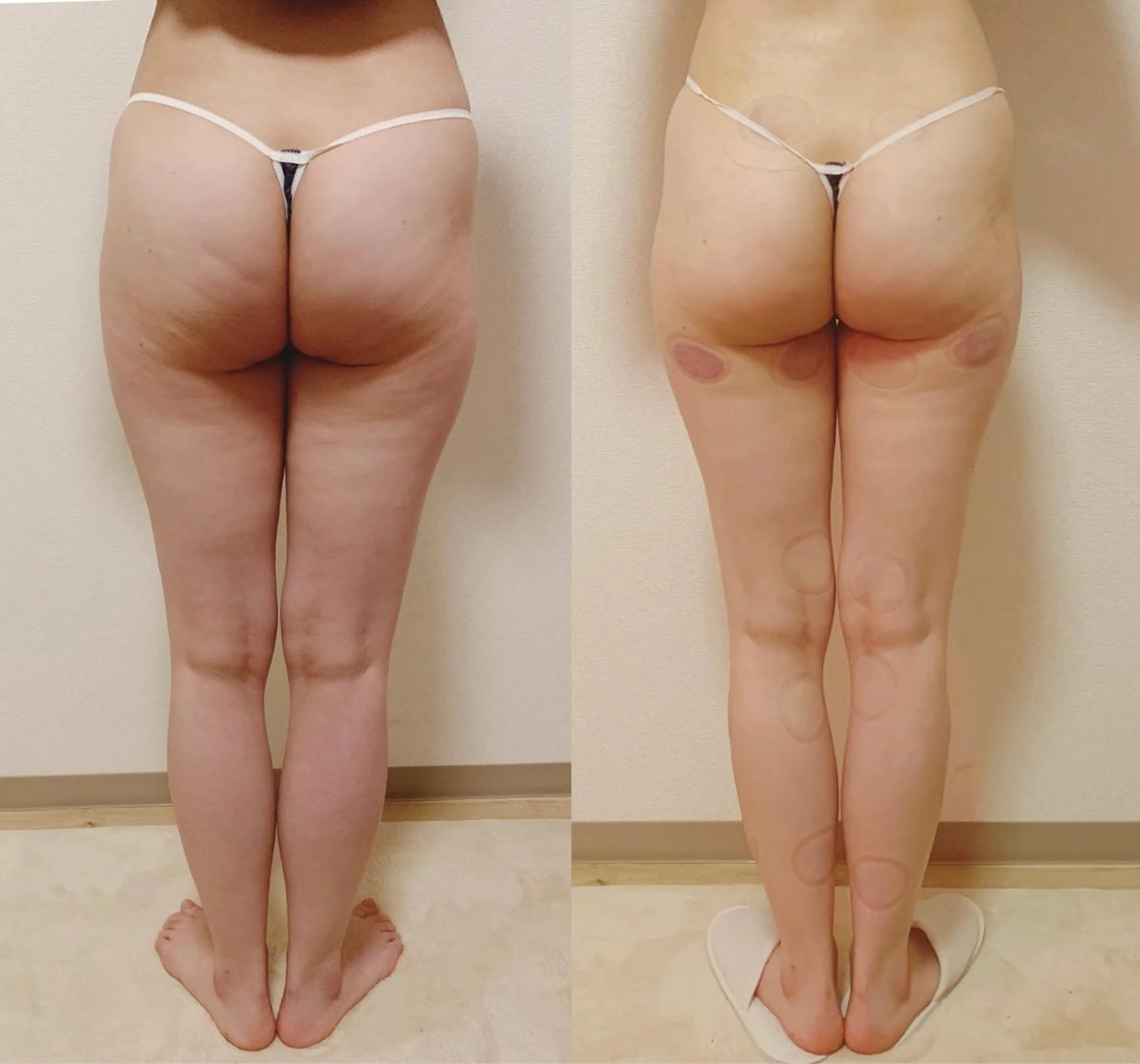 a  room salonのエステ・リラクイメージ