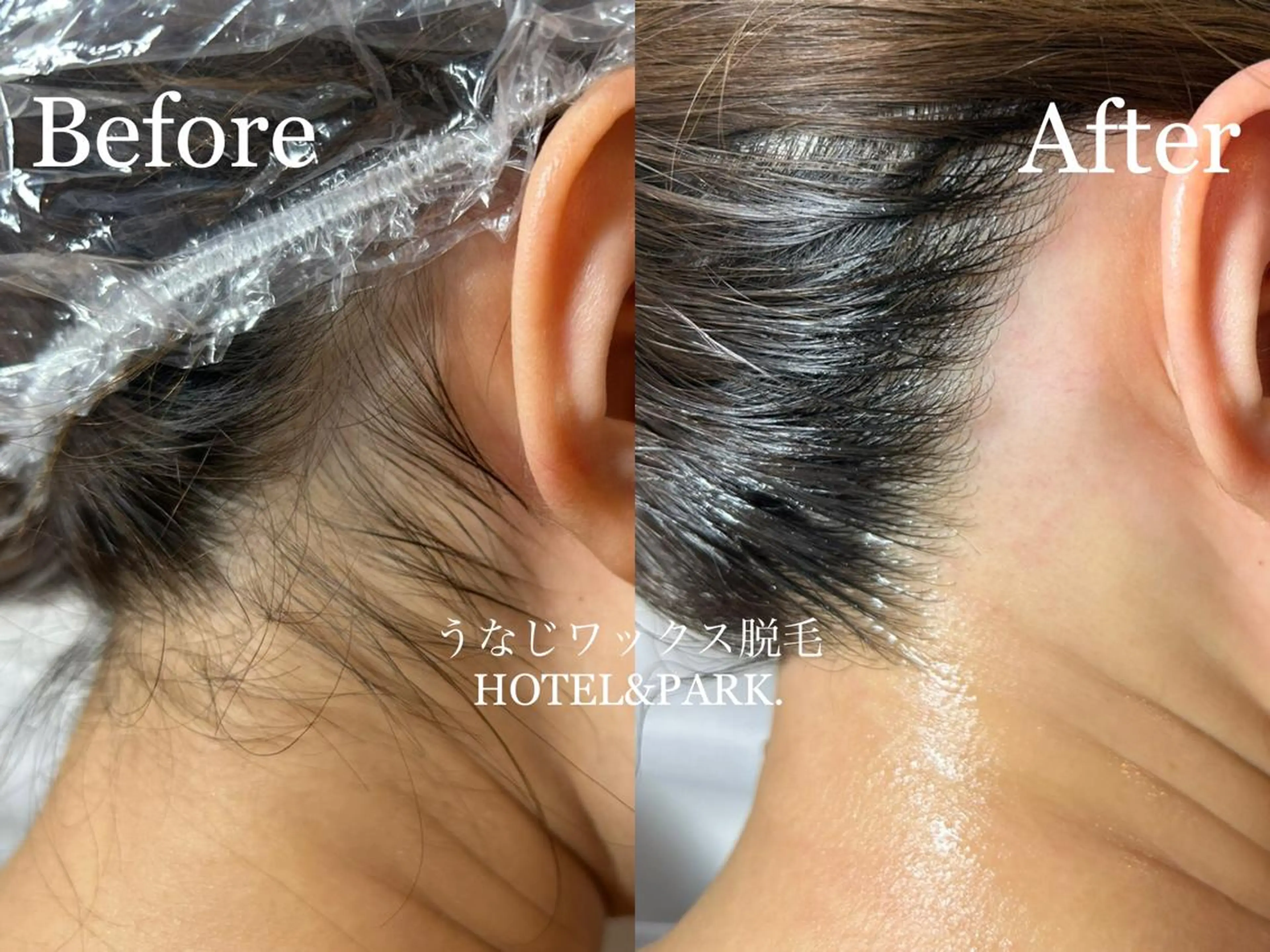 HOTEL&PARK . ワックス脱毛のエステ・リラクイメージ