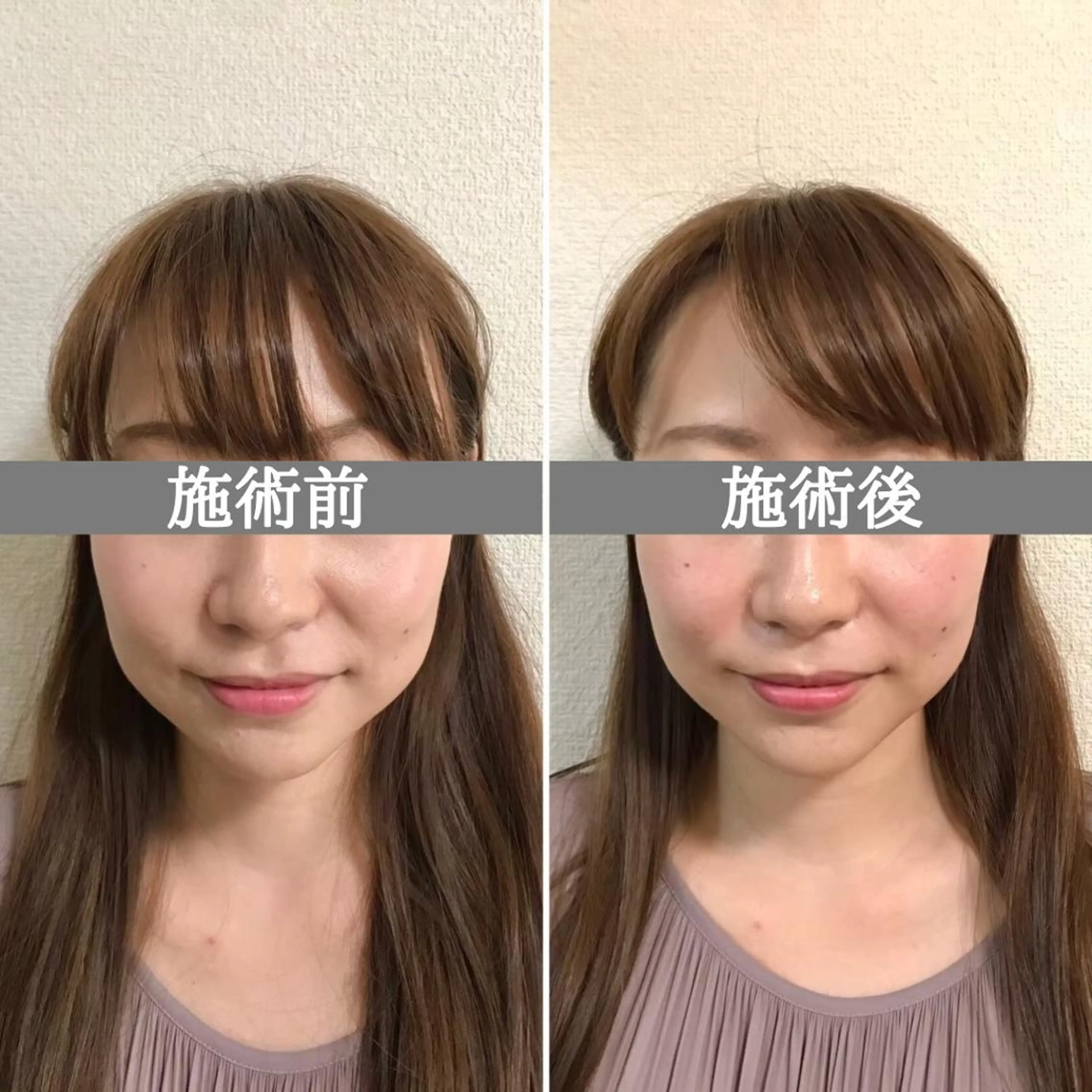 エステ リラク 美容整体サロン Chare人形町店のエステ・リラクイメージ