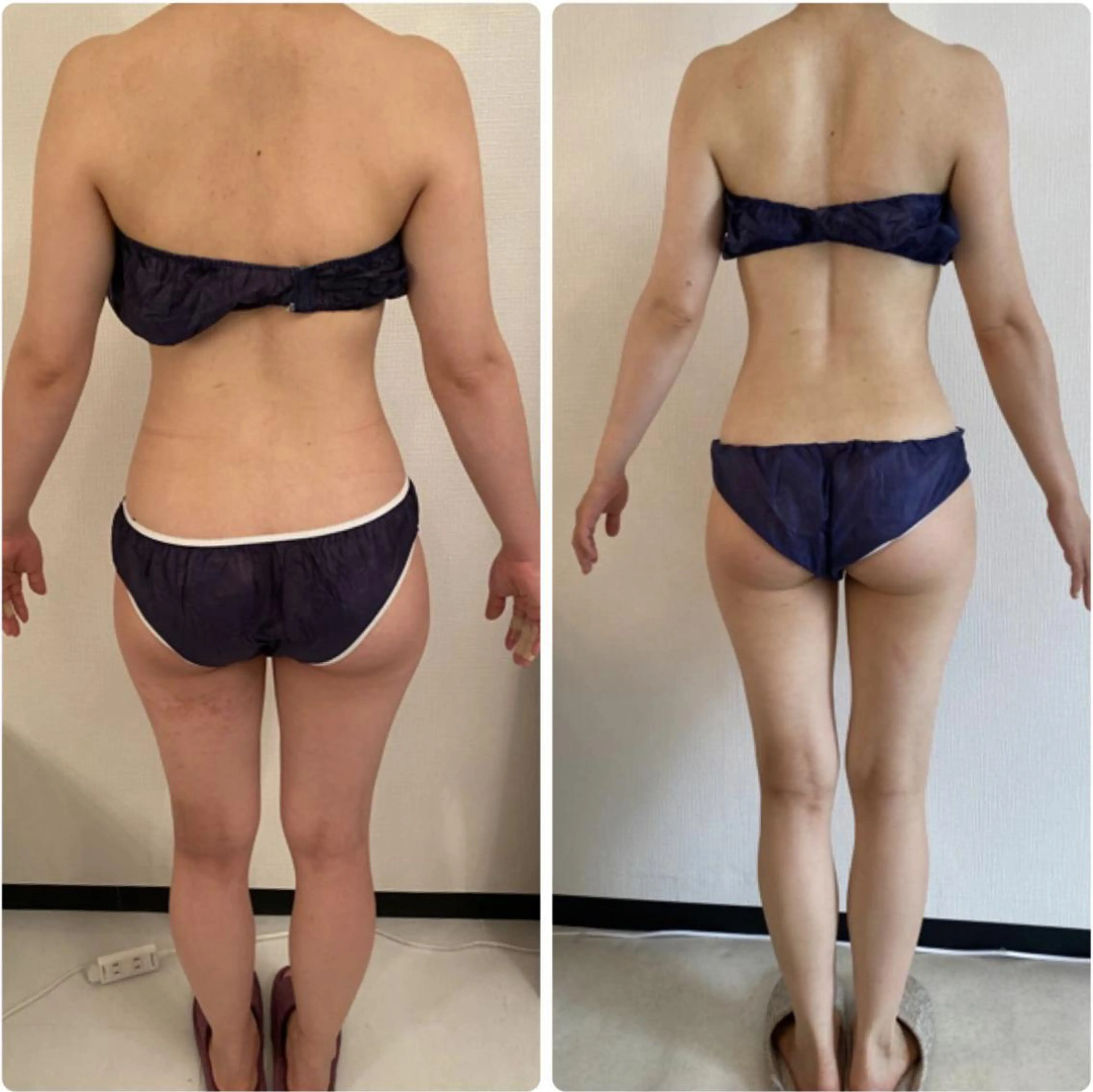 本格痩身BODY‼️腕、背中、お腹、脚、ヒップ、ウエスト、骨盤、美容整体込み💕の写真