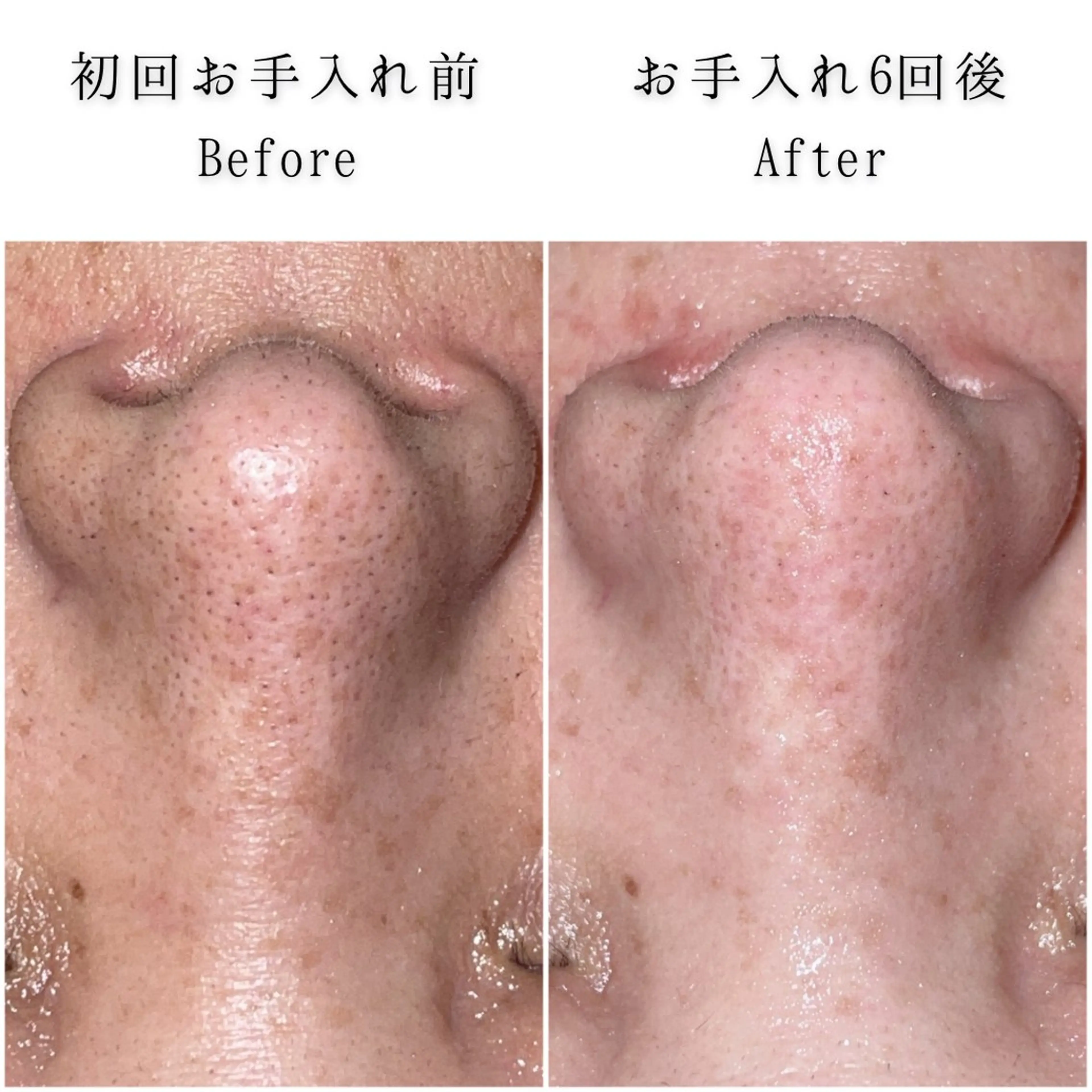 エステ SELF  BEAUTY gracia浦添店所属・gracia 浦添店のその他イメージ