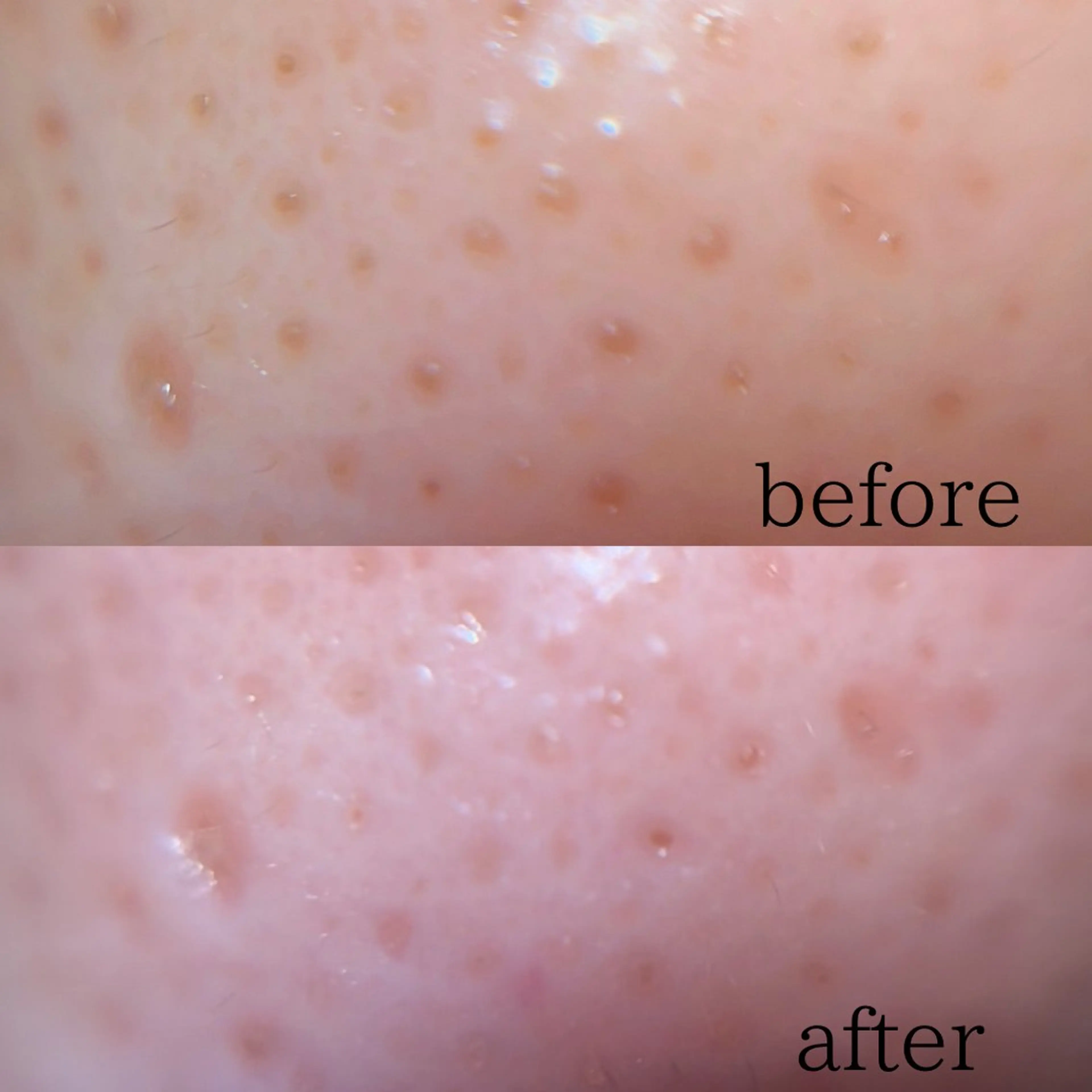 エステ 毛穴ケア/毛穴診断/ 毛穴洗浄〔心斎橋〕のエステ・リラクイメージ