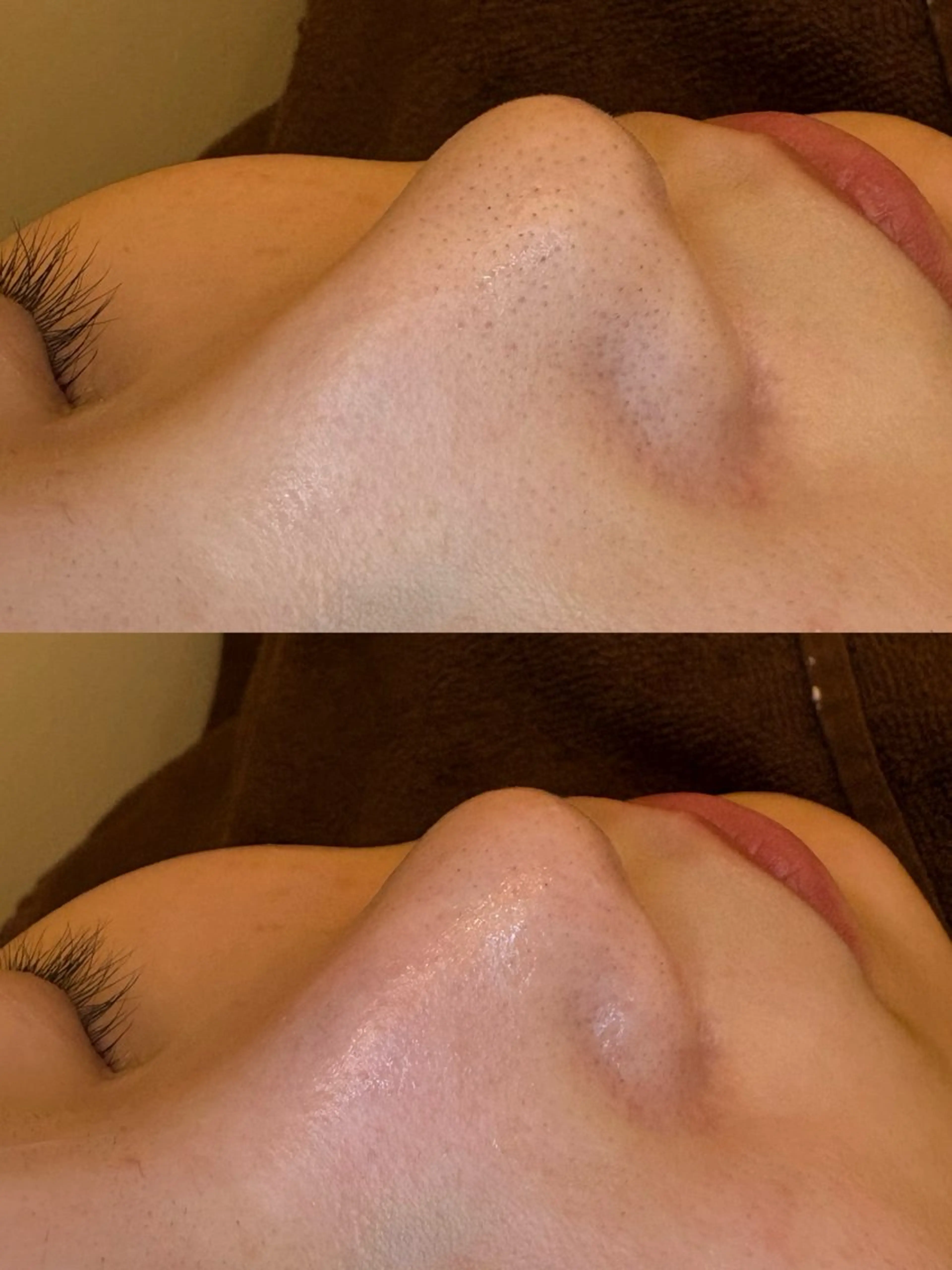 エステ EARTH coiffure beaute 新潟紫竹山店所属・🤍アベシュリ /フェイシャル🤍のエステ・リラクイメージ