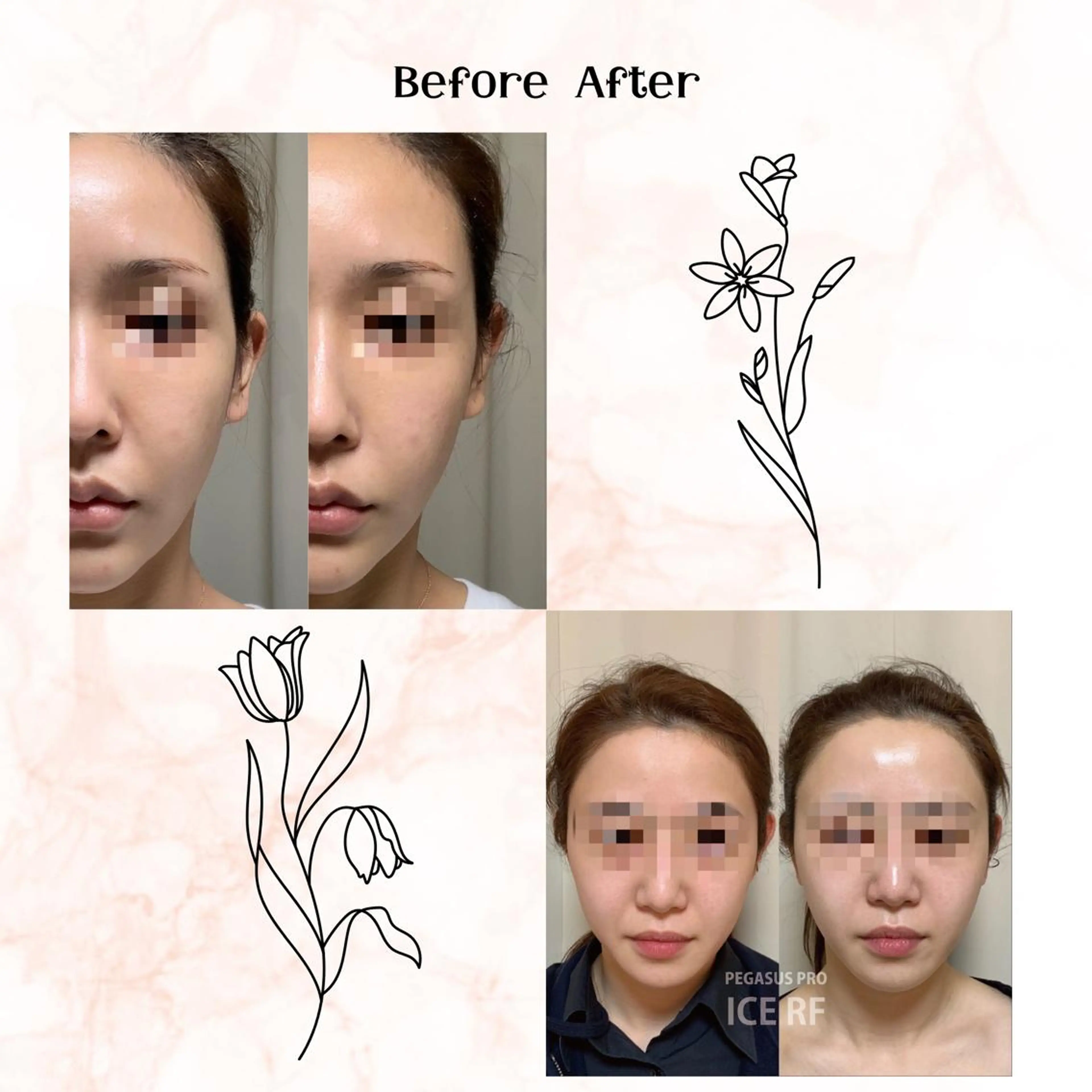 メンズ 男女同額完全個室脱毛 LEPIA内田のエステ・リラクイメージ