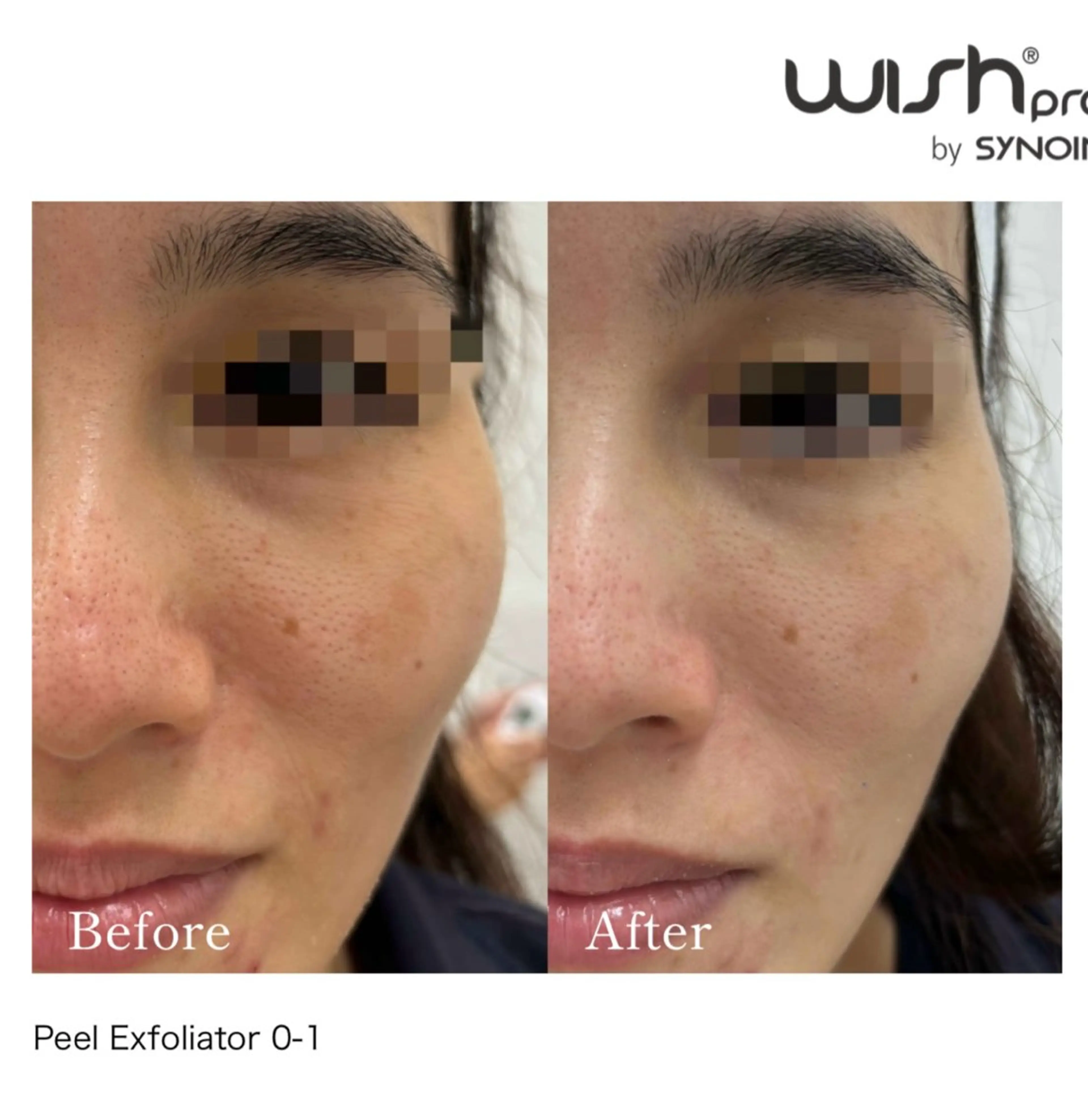 エステ Total Beauty salon Bloom所属・肌育WISHpro 専門サロンBloomのエステ・リラクイメージ