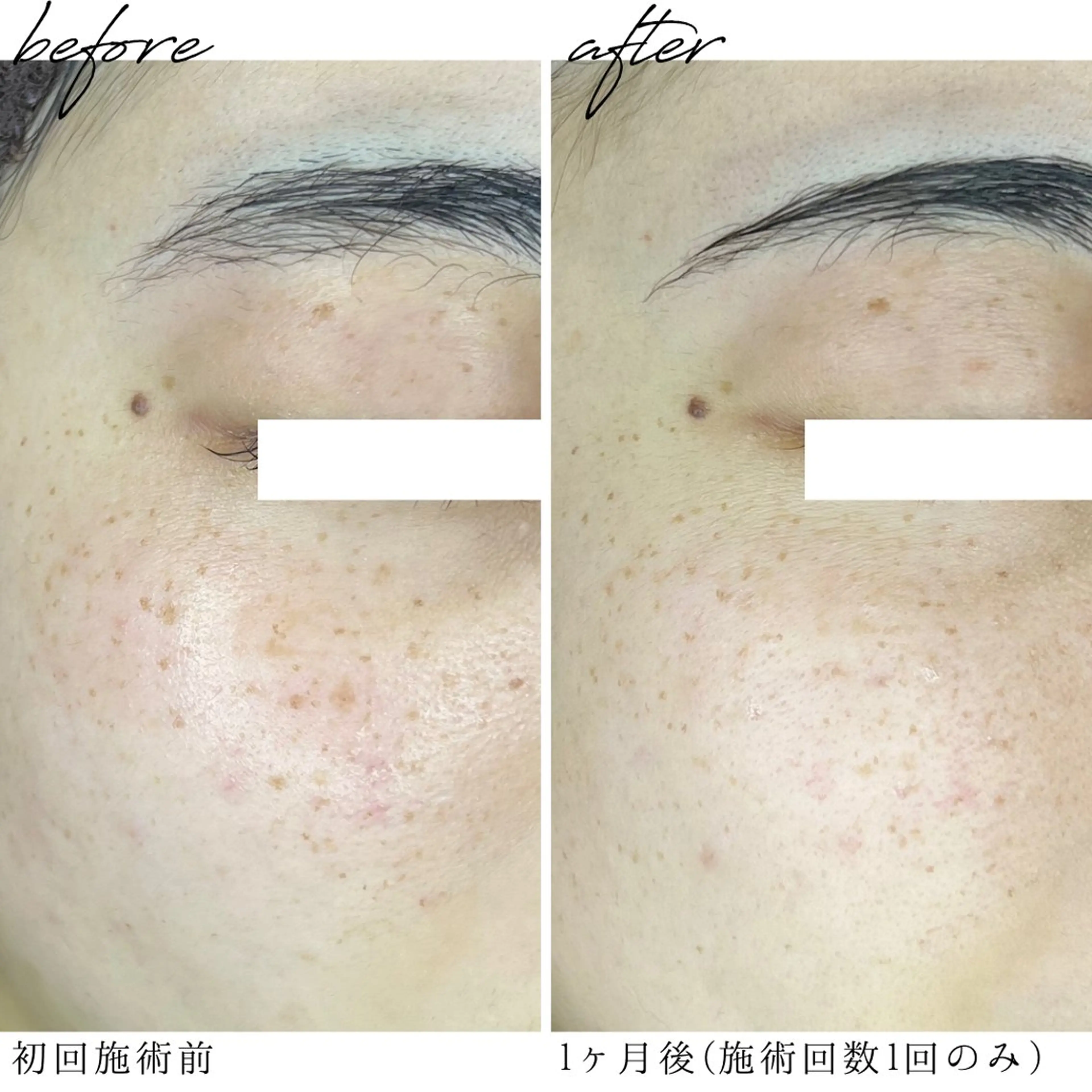 エステ 最新シミケアLily de pearlのエステ・リラクイメージ