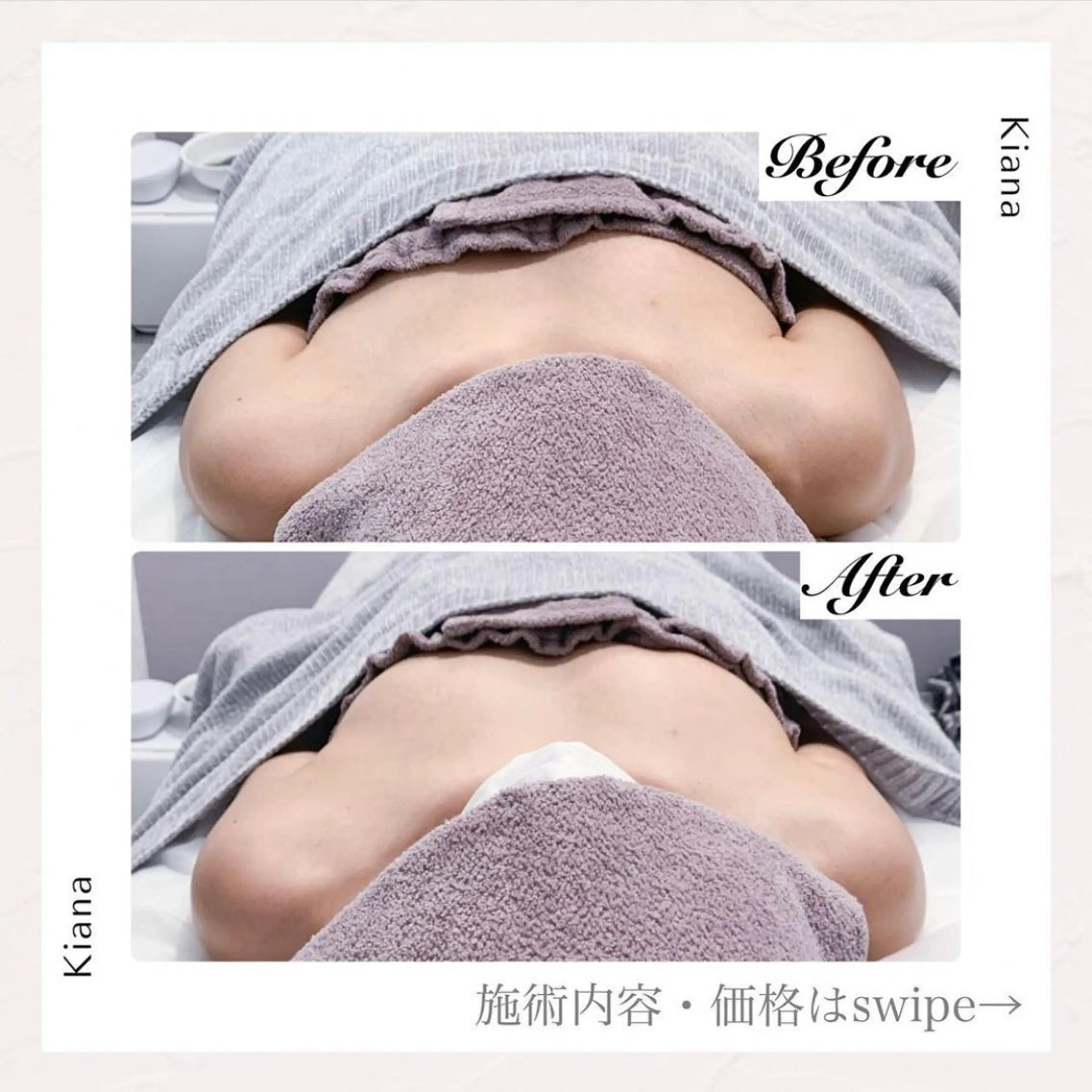 エステ リラク バスト専門Kiana 風のエステ・リラクイメージ