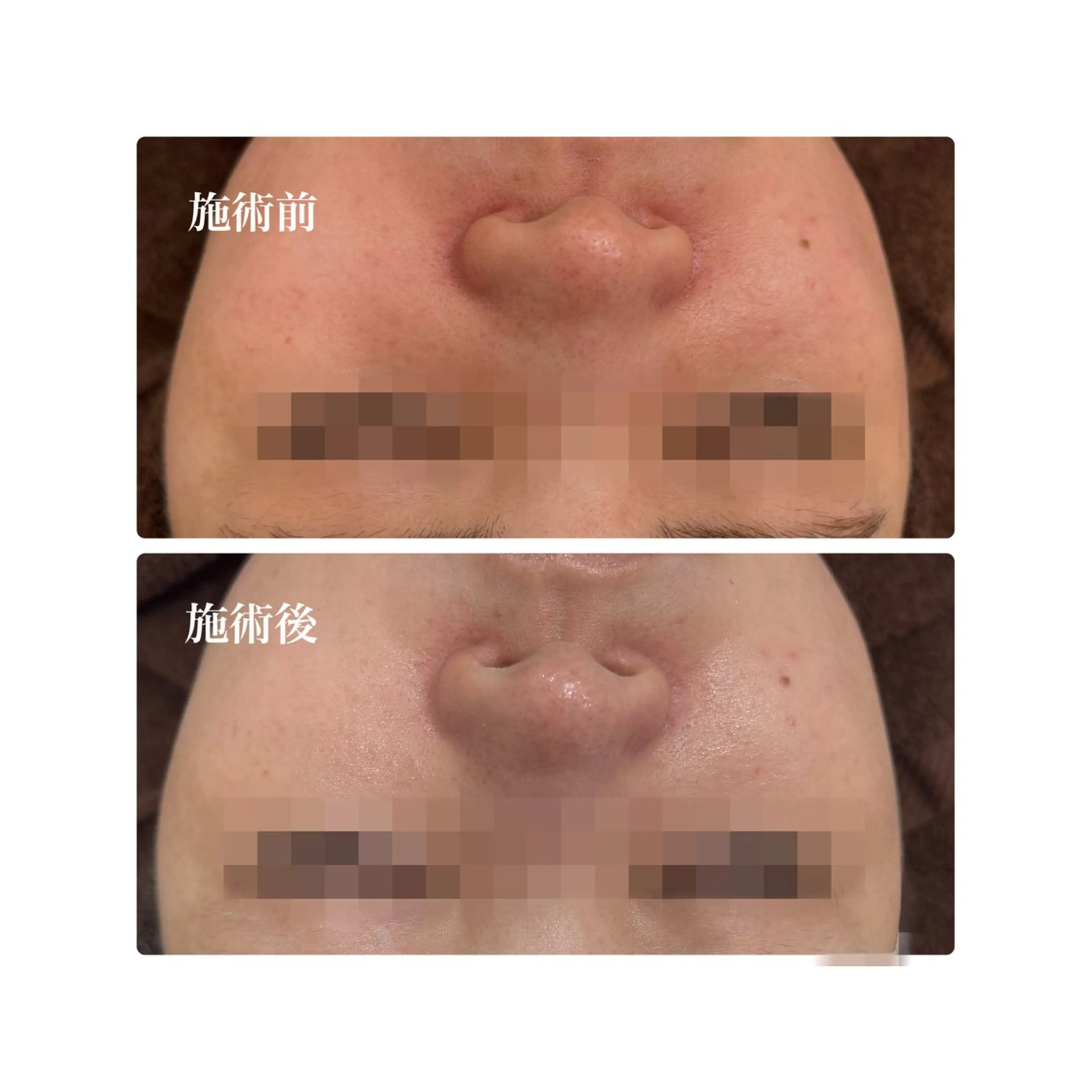 エステ 10nick BEAUTY SALON所属・中林 萌々花のエステ・リラクイメージ