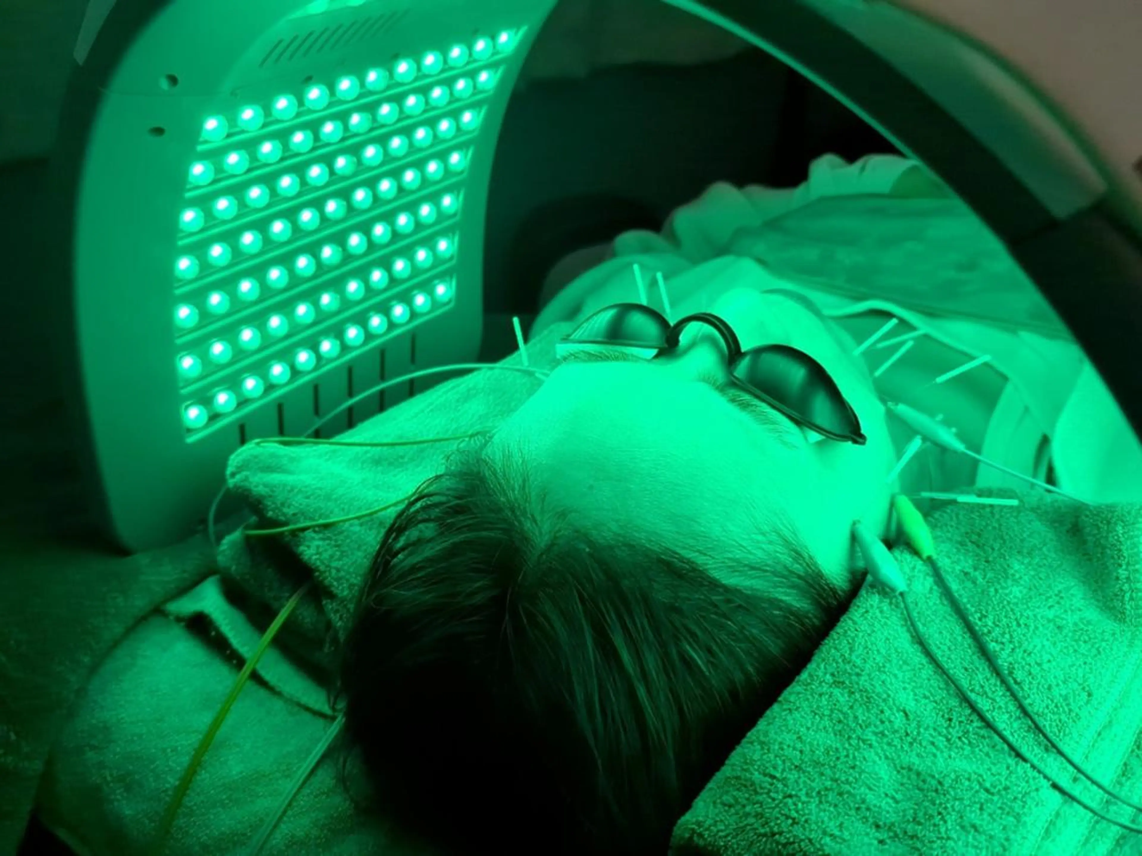 美容とカラダの鍼灸 サロン やなけんのエステ・リラクイメージ