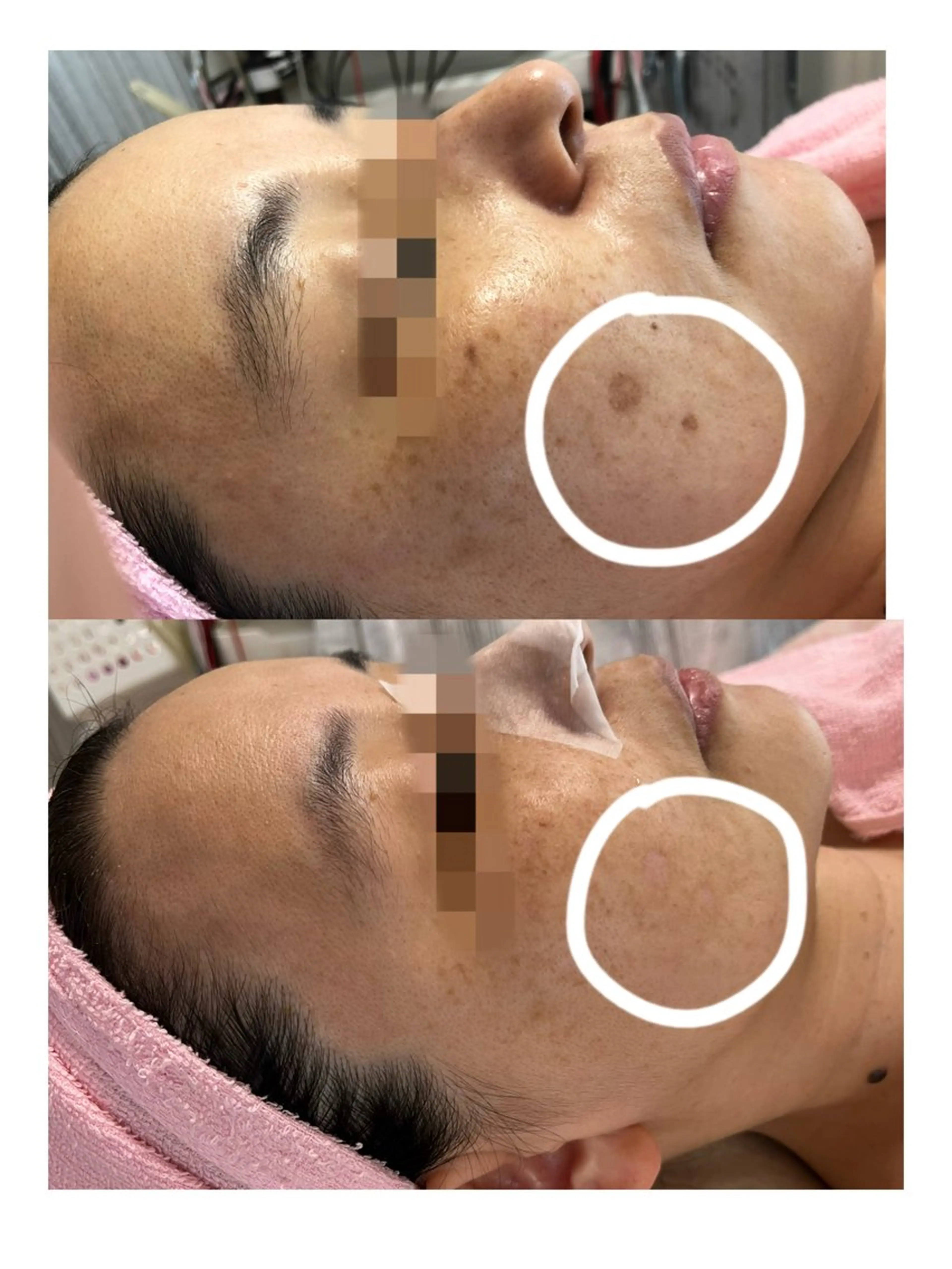 顔専門エステ プリエールビューティのエステ・リラクイメージ