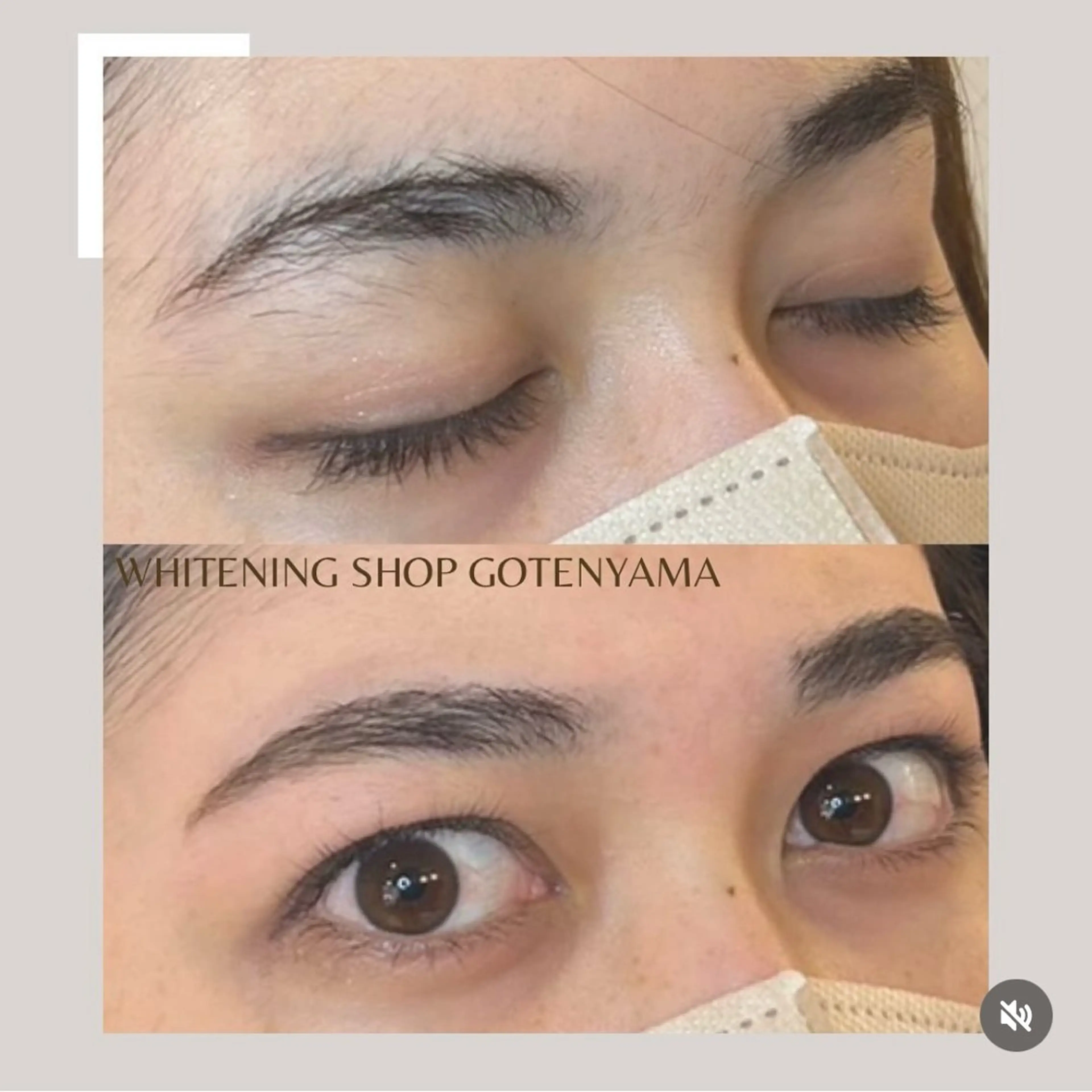 ホワイトニングショッ 吉祥寺2号店のその他イメージ