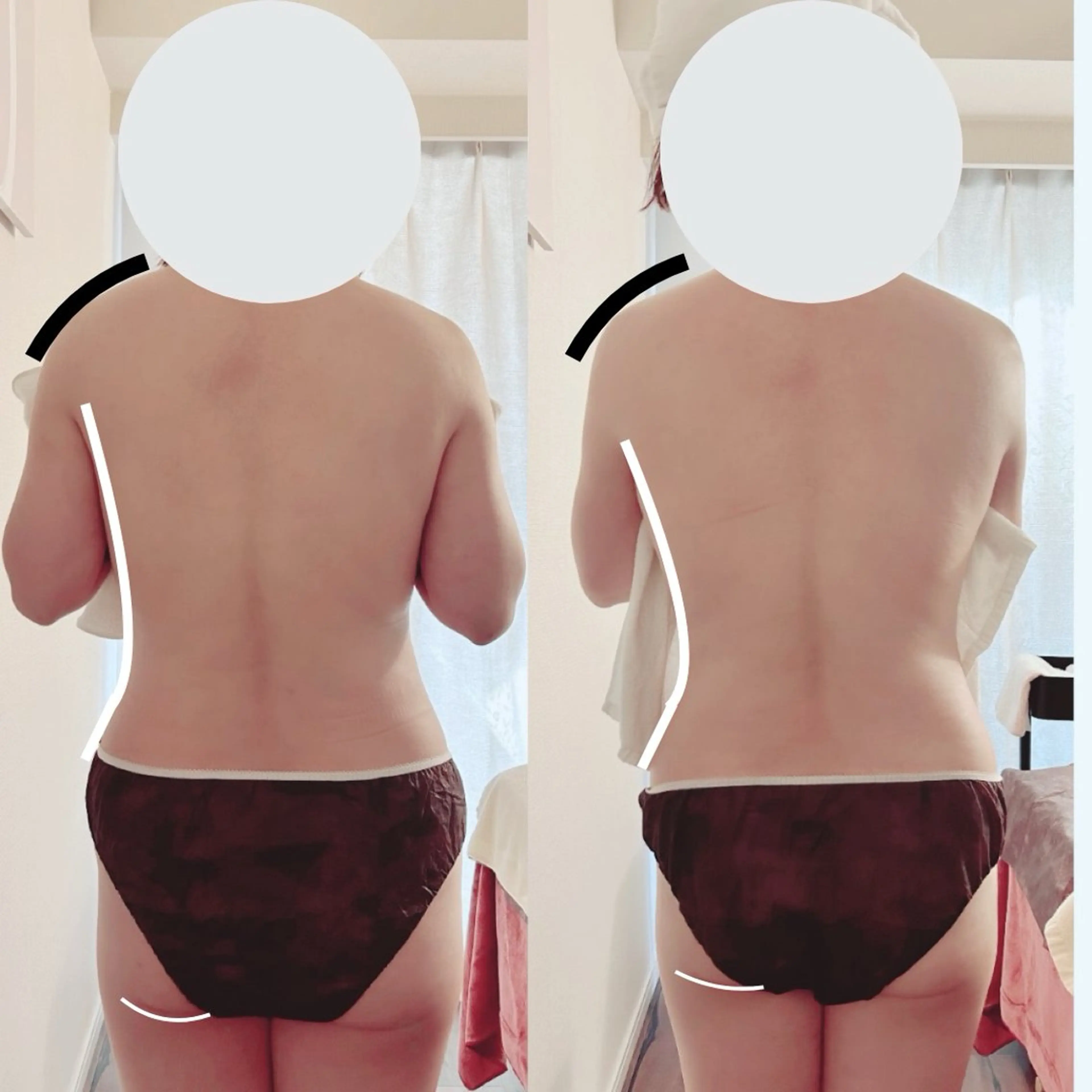 脚痩せ&ヒップアップ 専門サロン｜さくらのエステ・リラクイメージ