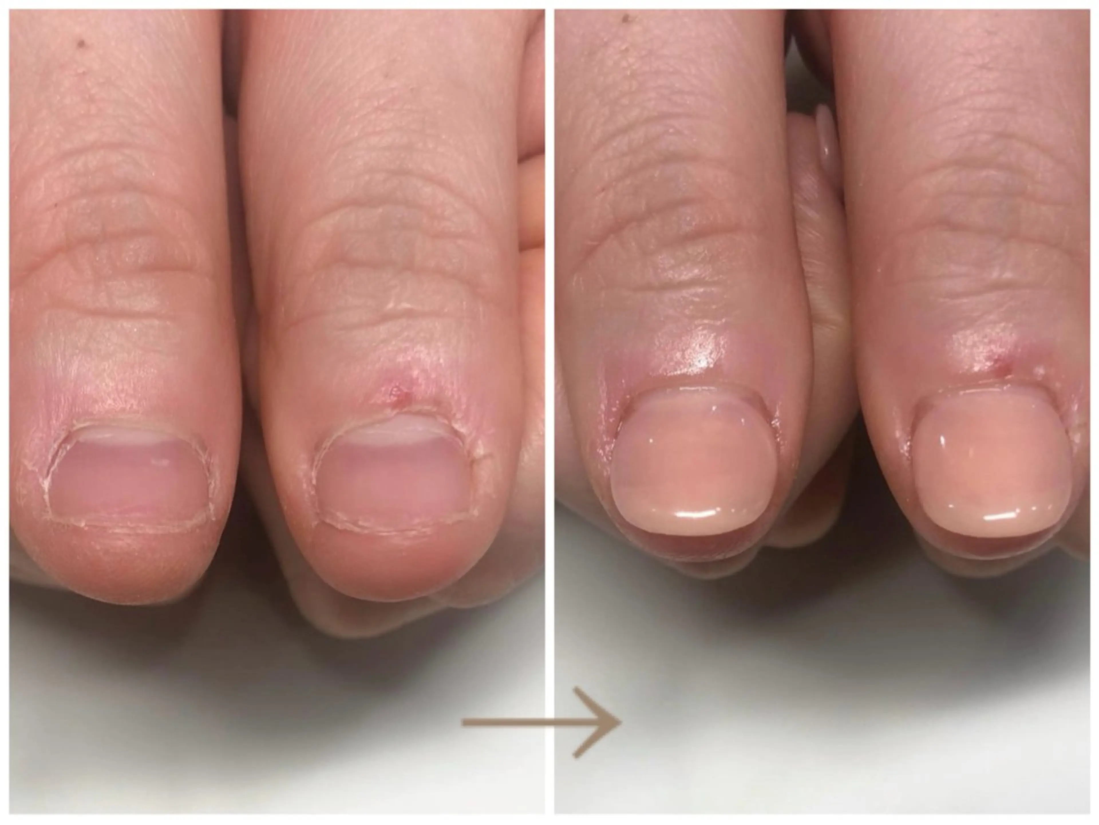 ネイル ワンカラーネイル 深爪矯正・自爪育成 ヴェールリムのネイルデザイン