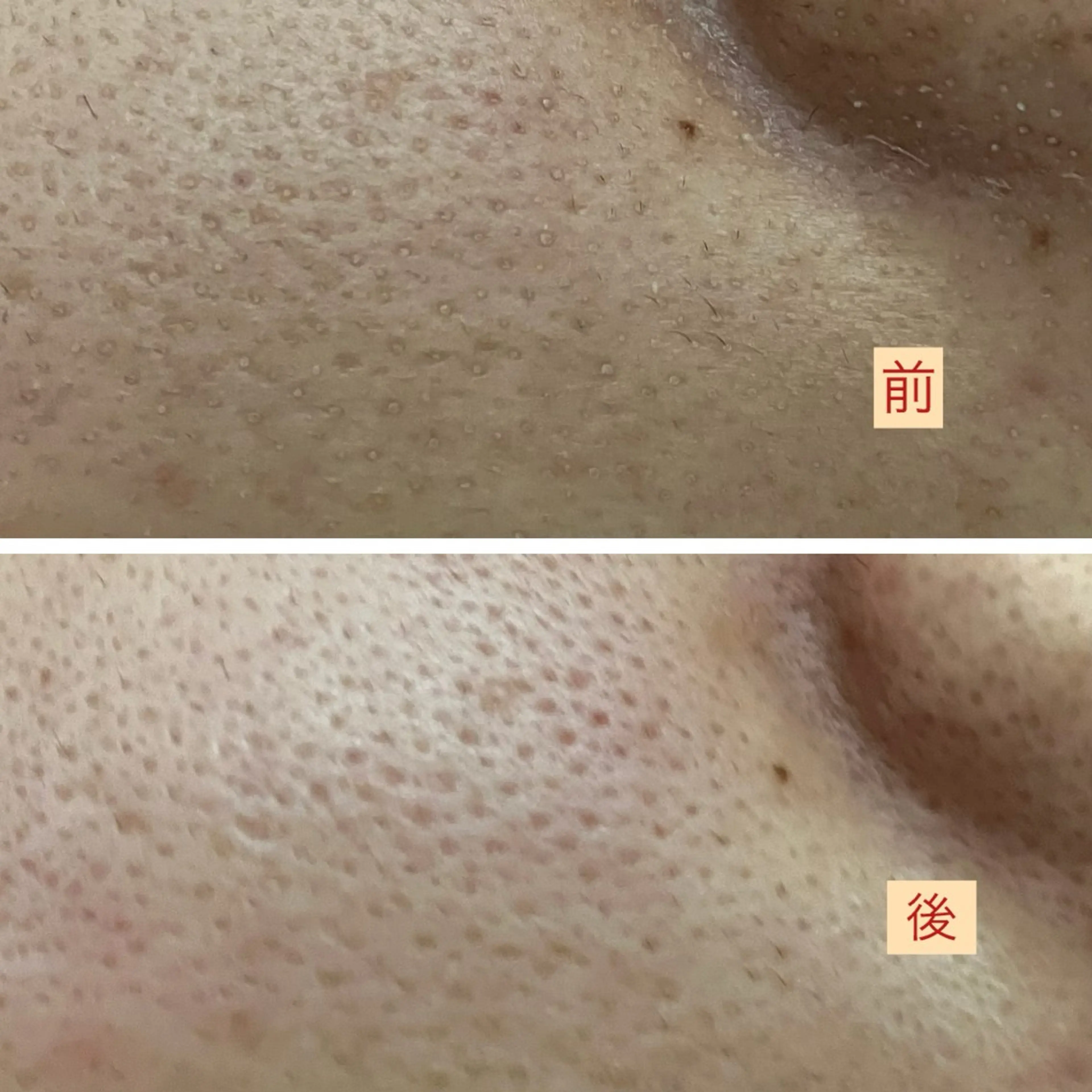 その他 たるみ改善小顔エステ 堀葉月のその他イメージ