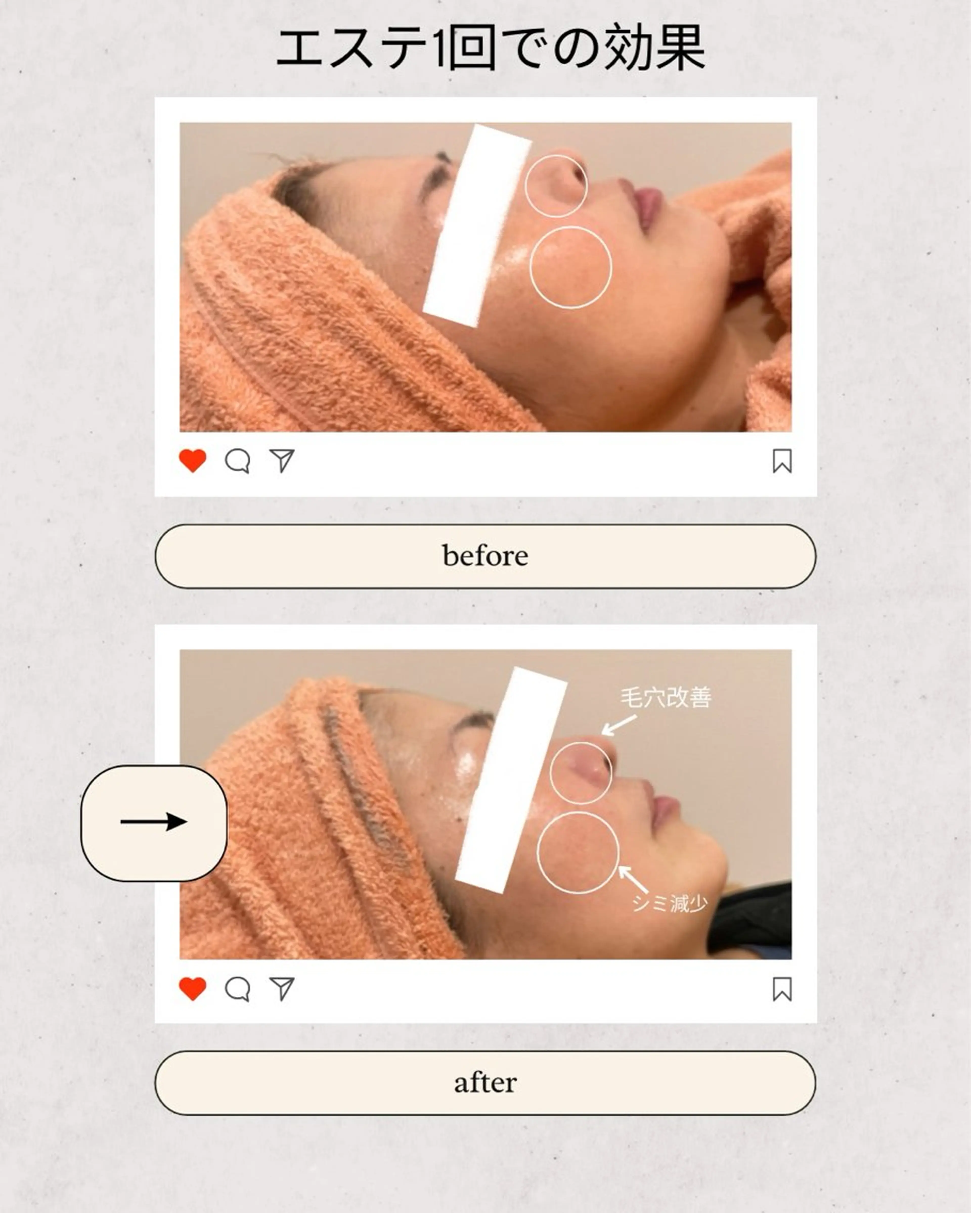 エステ リラク CSサロン Amule所属・Amule anna🦋のエステ・リラクイメージ
