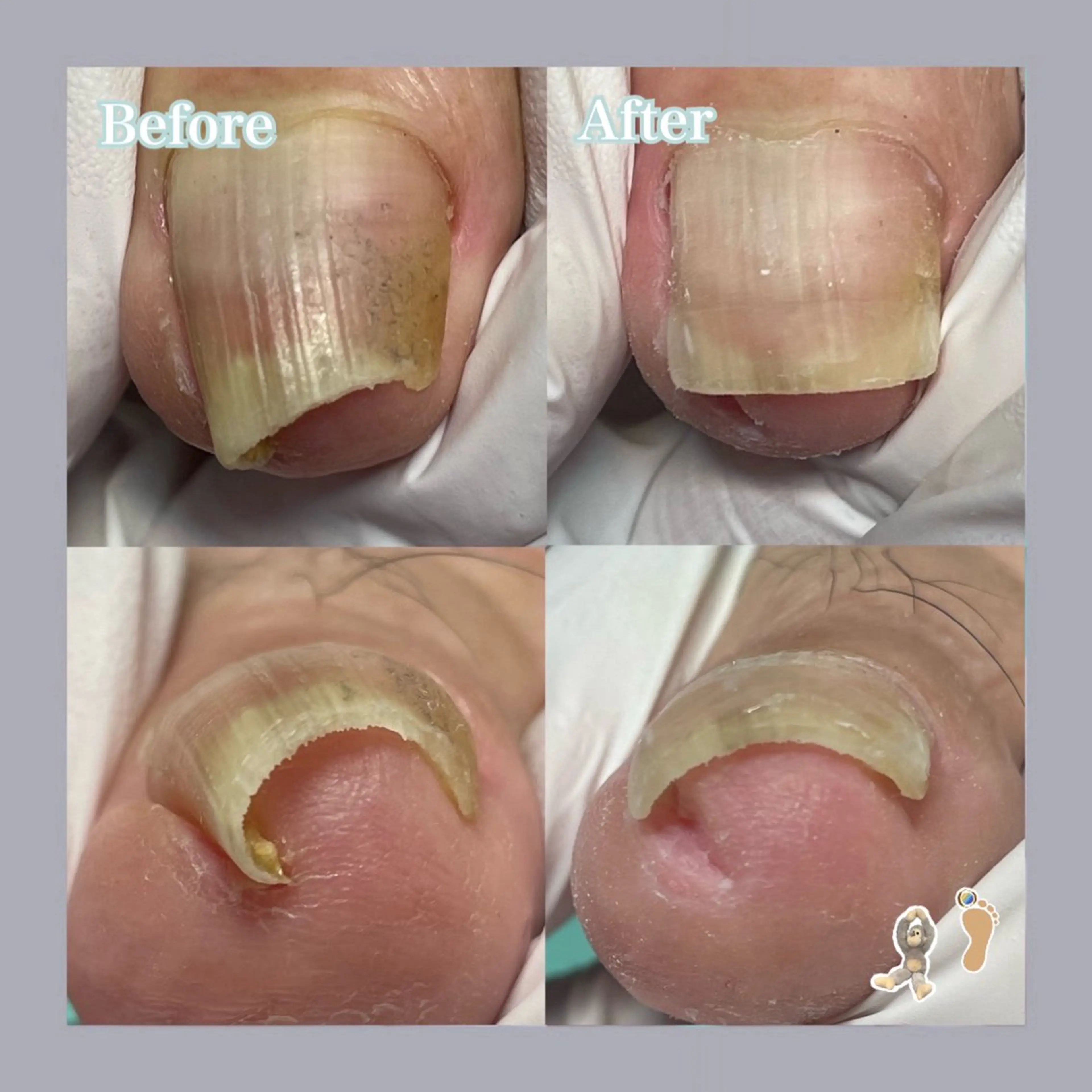 ネイル 巻き爪補正店 大阪天王寺店のネイルデザイン