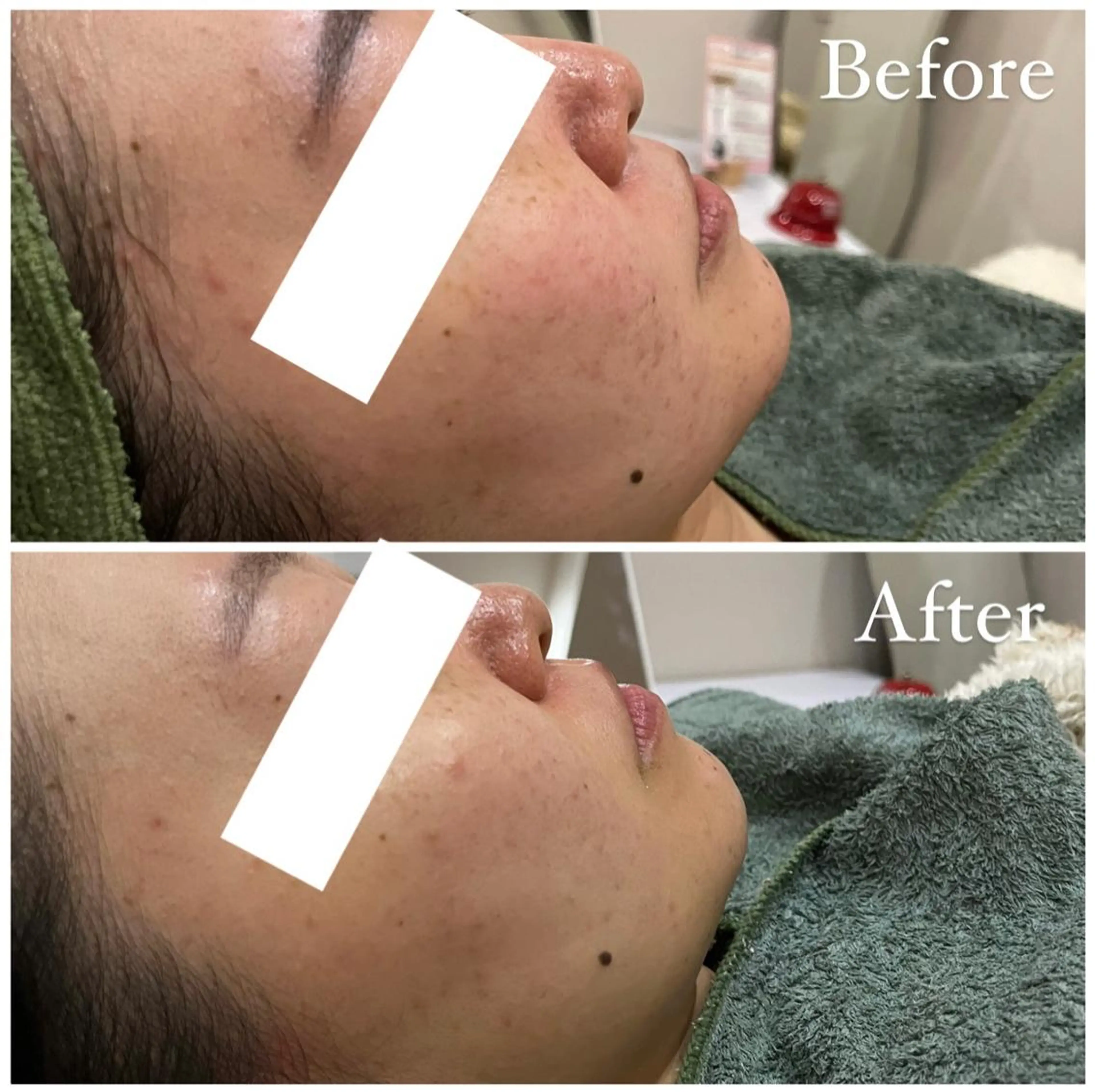 ハーブピーリング専門 muro.のエステ・リラクイメージ