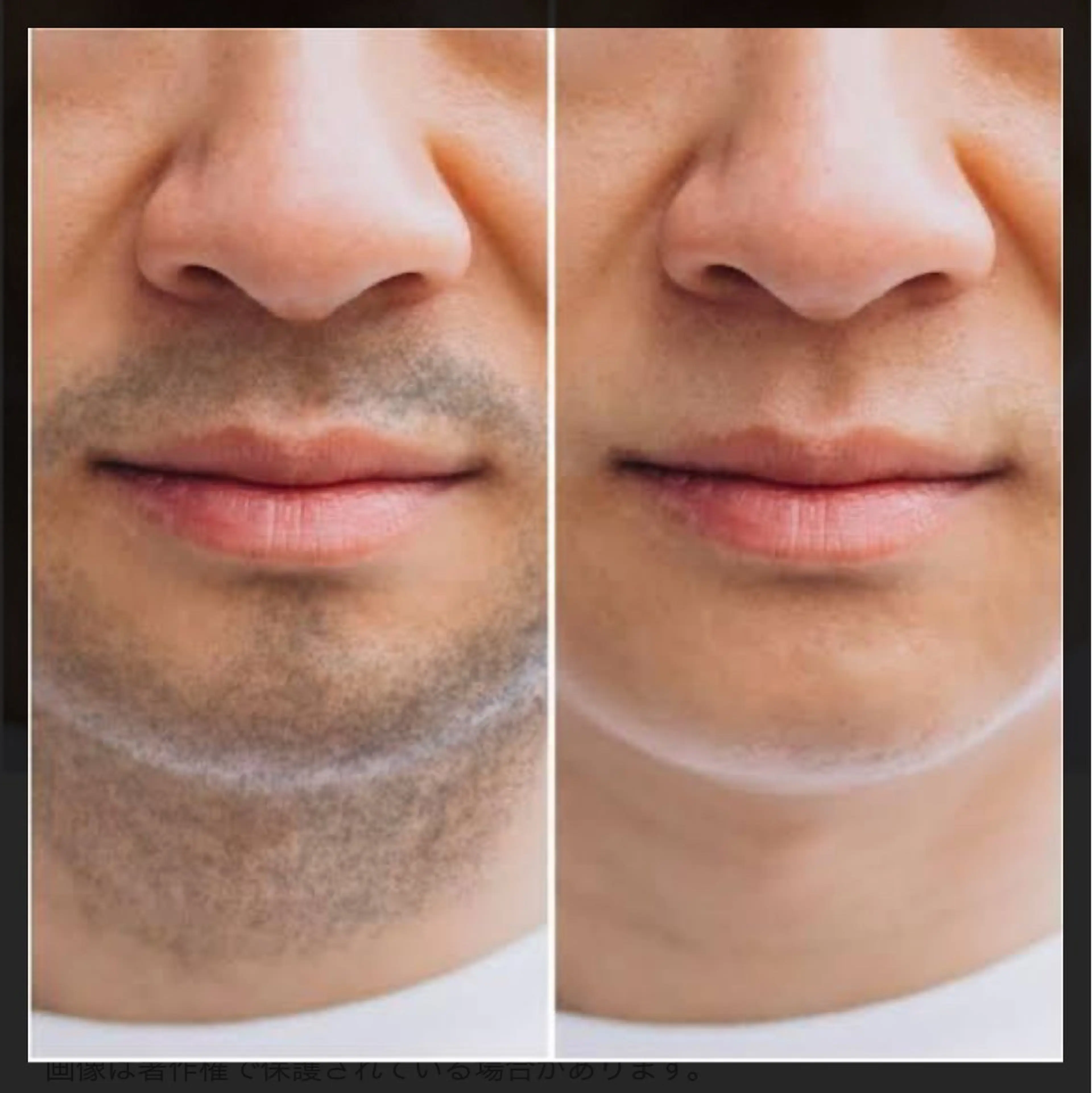 男性ヒゲの写真