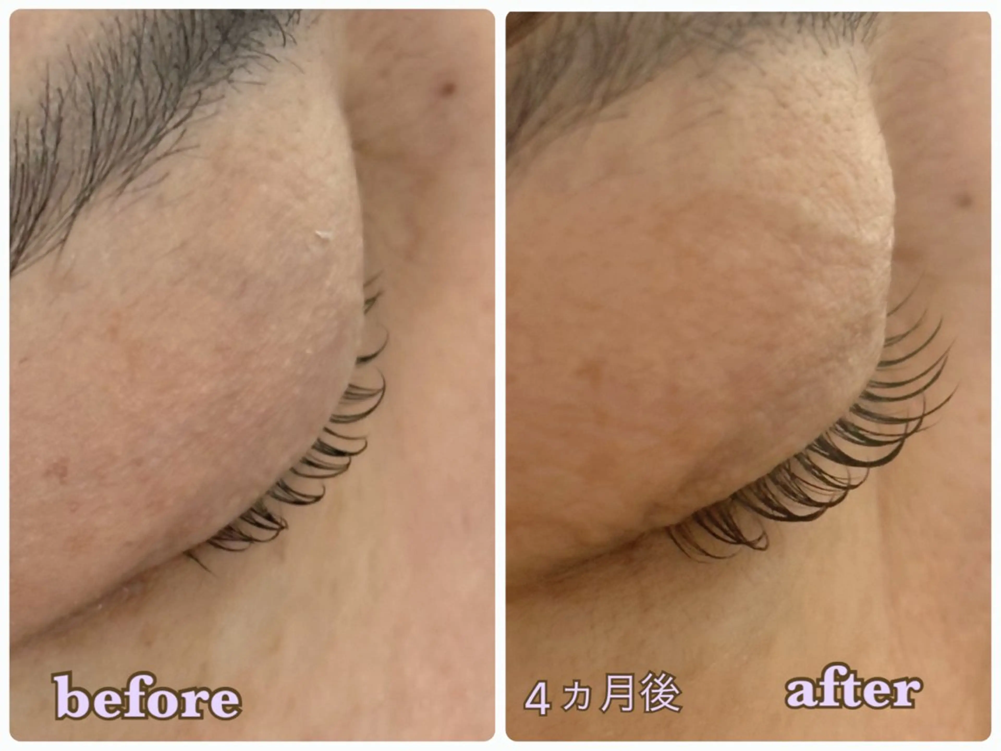 マツエク・マツパ 一重×まつ毛パーマ マツパ ⁺˚･༓☾アルーシェ みゆり☽༓･˚⁺のマツエク・マツパデザイン