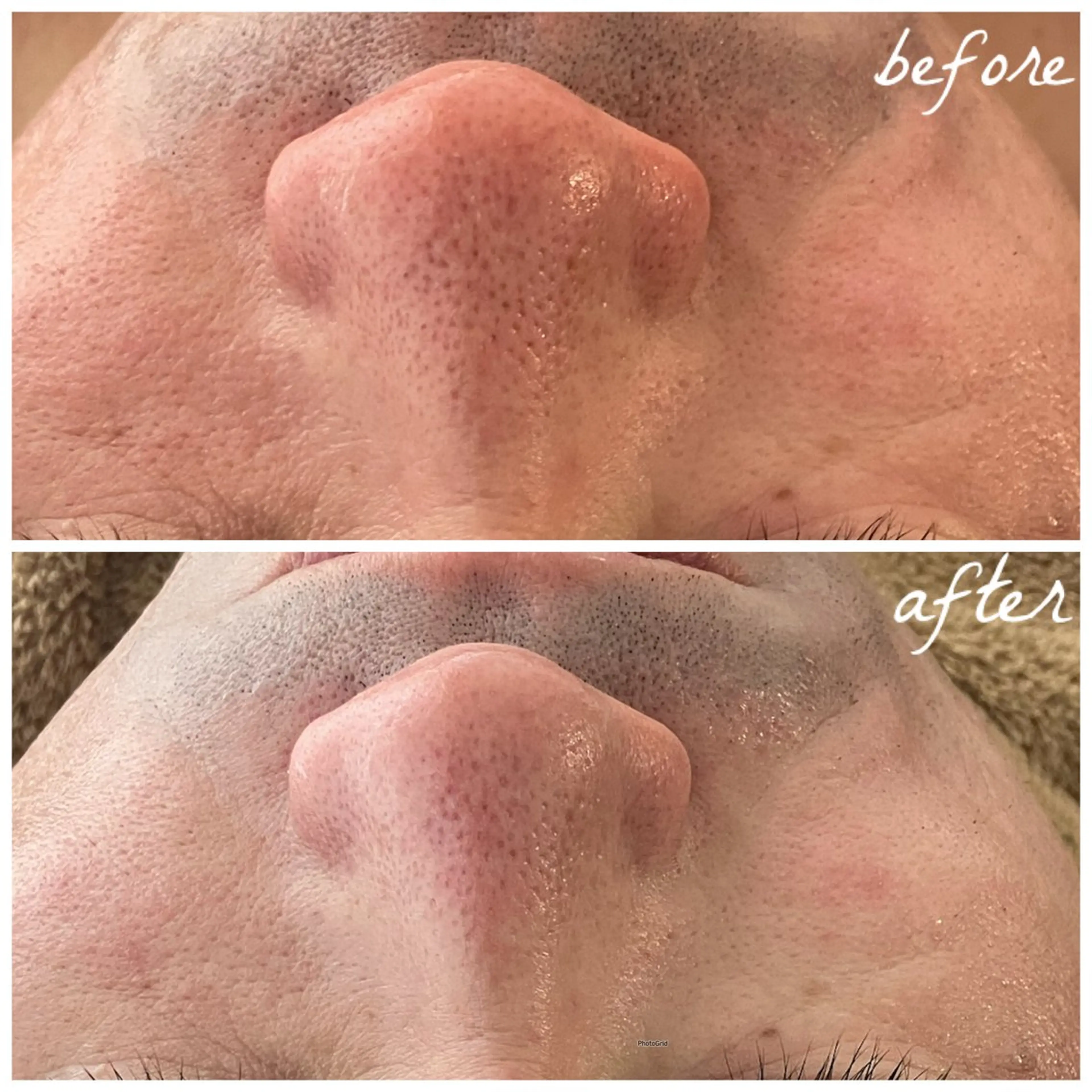 メンズ エステ メナード岐阜茜部 杉浦のエステ・リラクイメージ