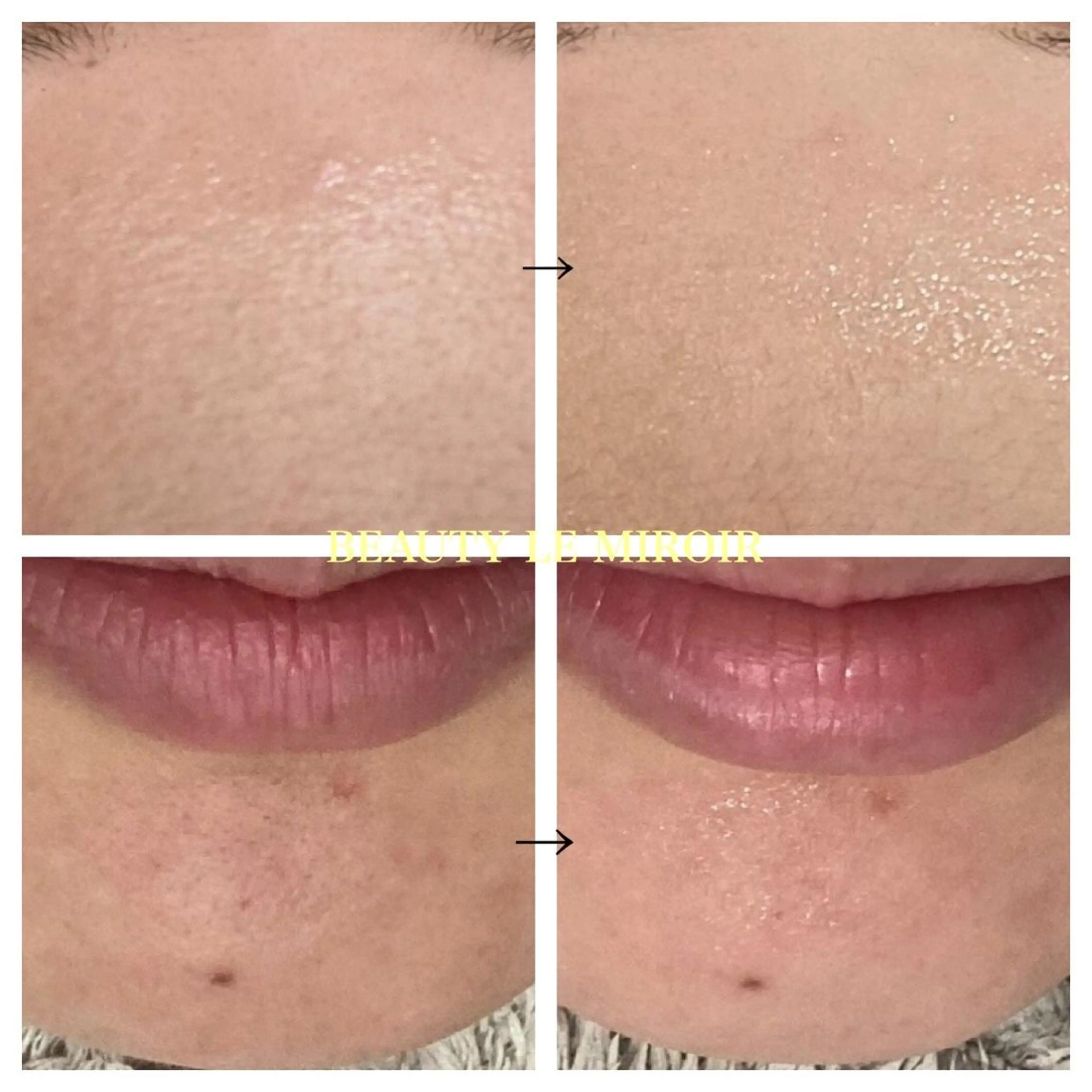 ビューティー ミロワールのエステ・リラクイメージ