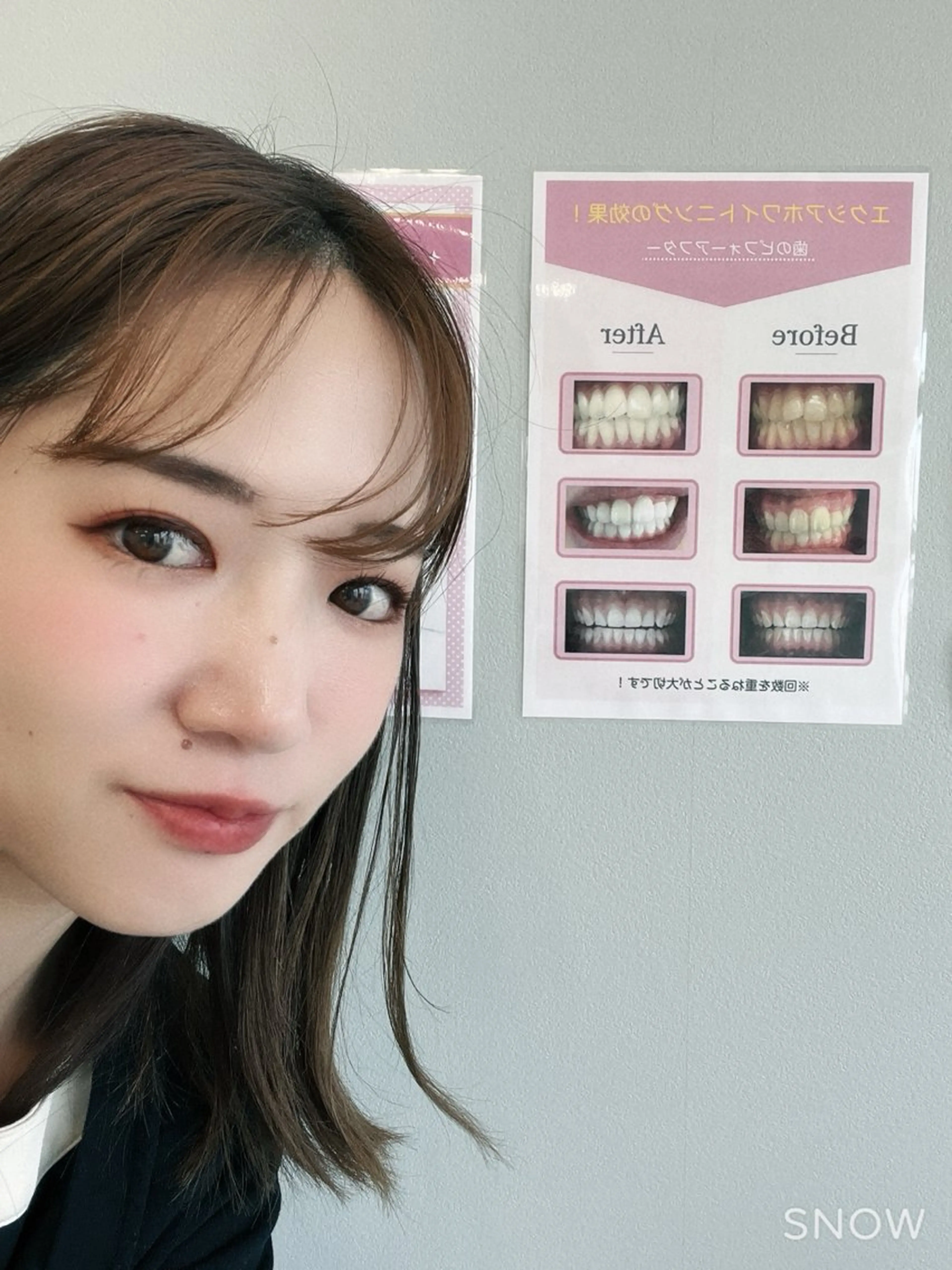 その他 エクシアホワイトニング草津店所属・nanami -ホワイトニングのその他イメージ