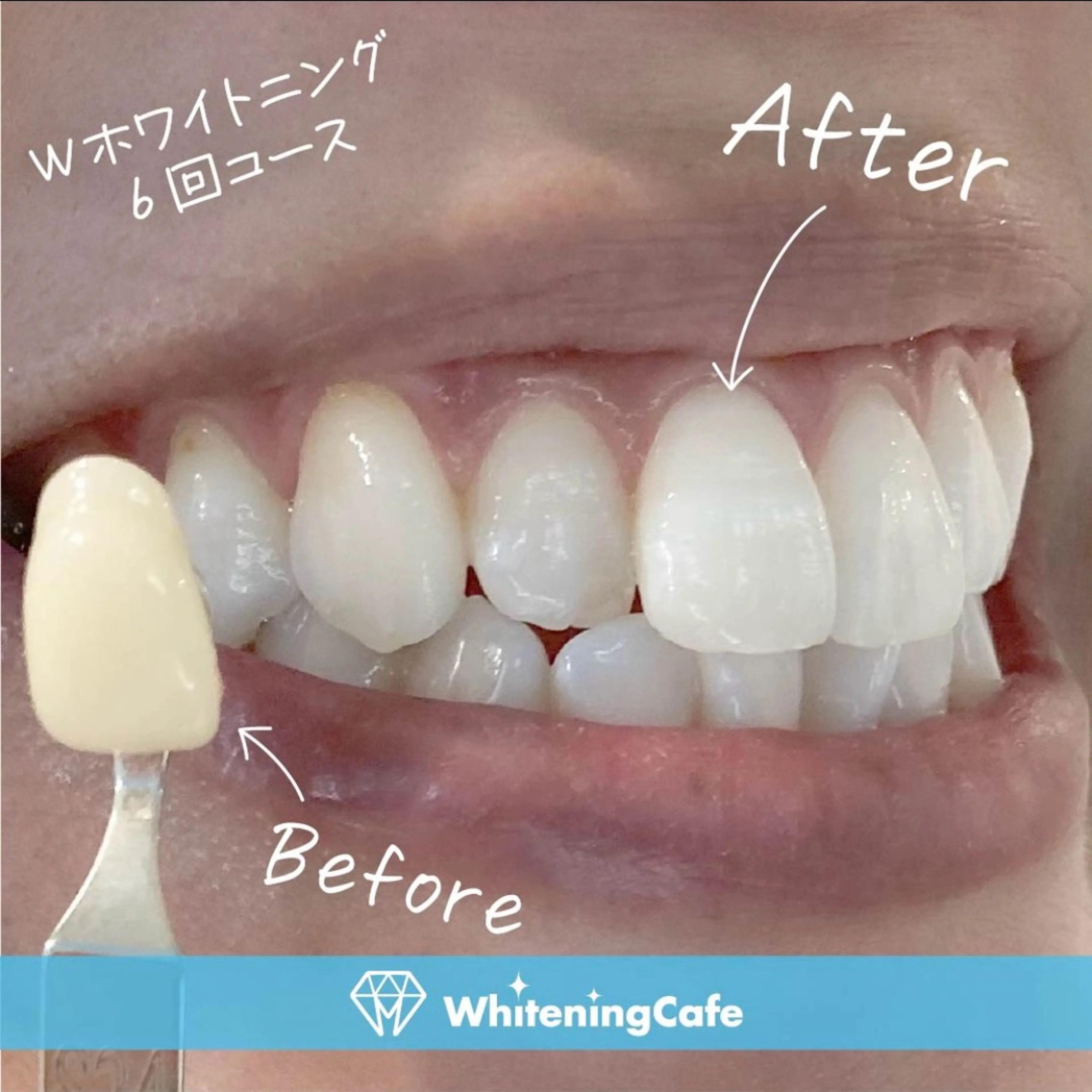 ホワイトニングカフェ神戸元町店所属・ホワイトニングカフェ 神戸元町店のエステ・リラクイメージ