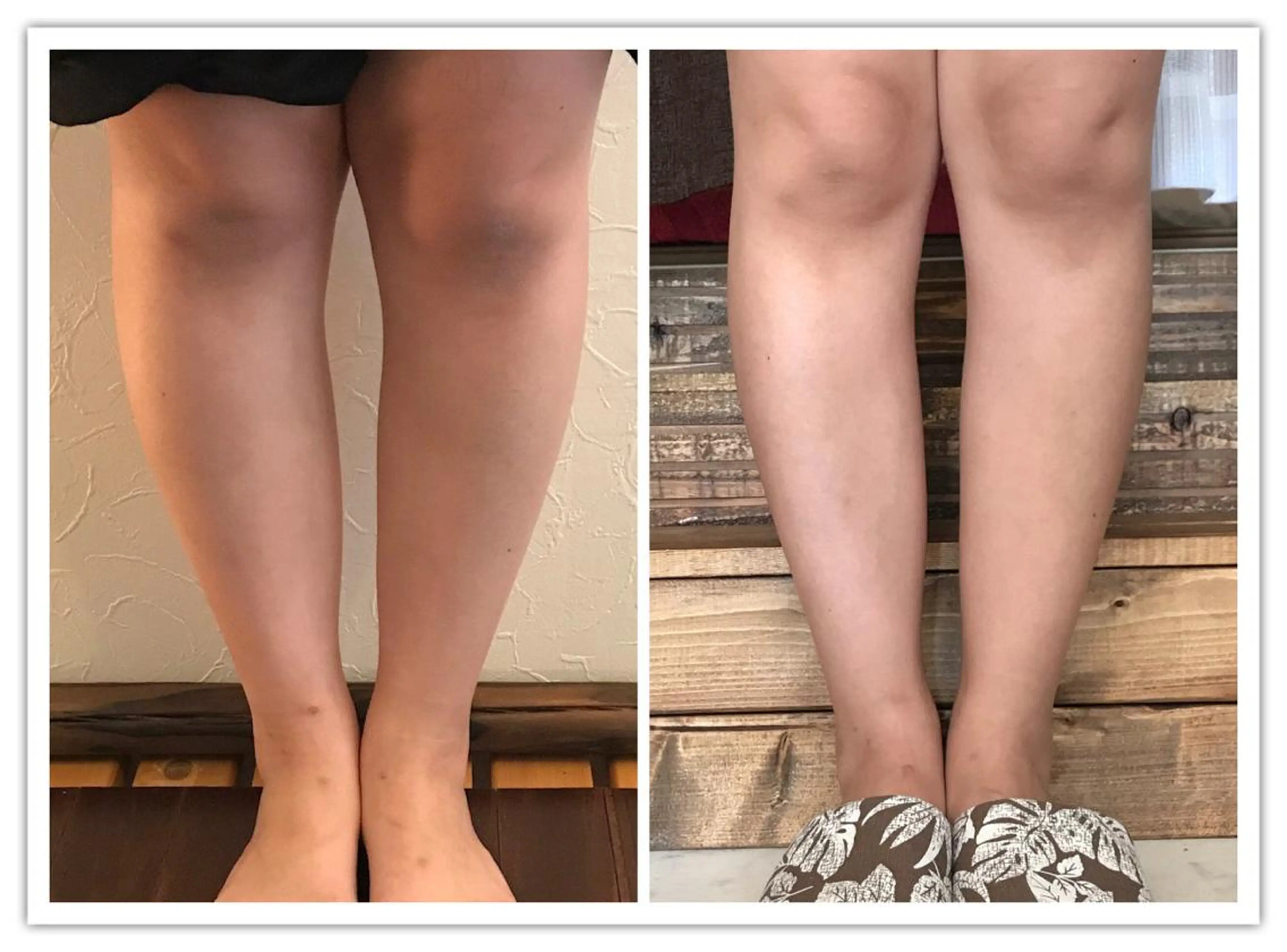 【足圧】鬼👹リンパ 身体整うサロンのエステ・リラクイメージ