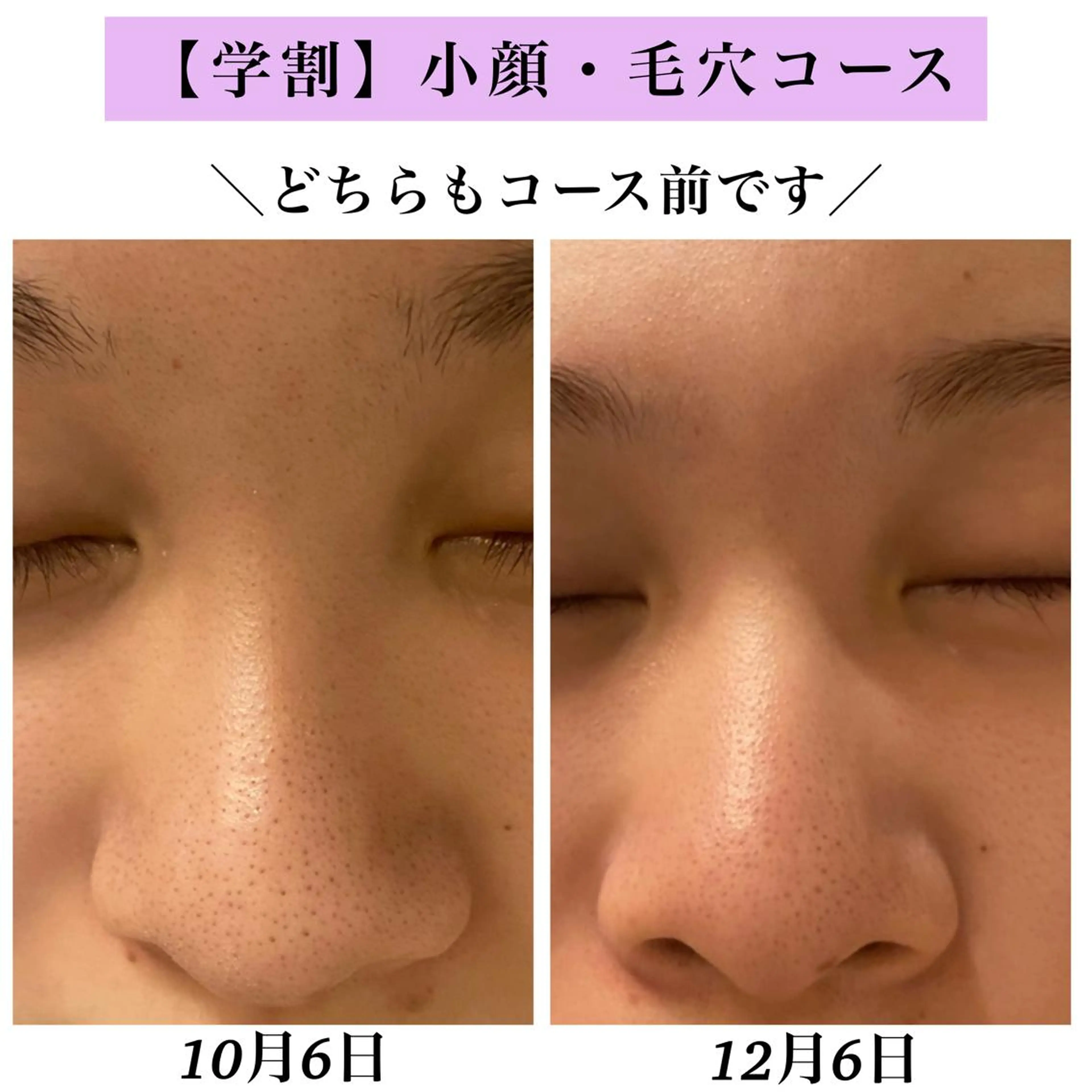 Bellesthe （ベルエステ）のエステ・リラクイメージ