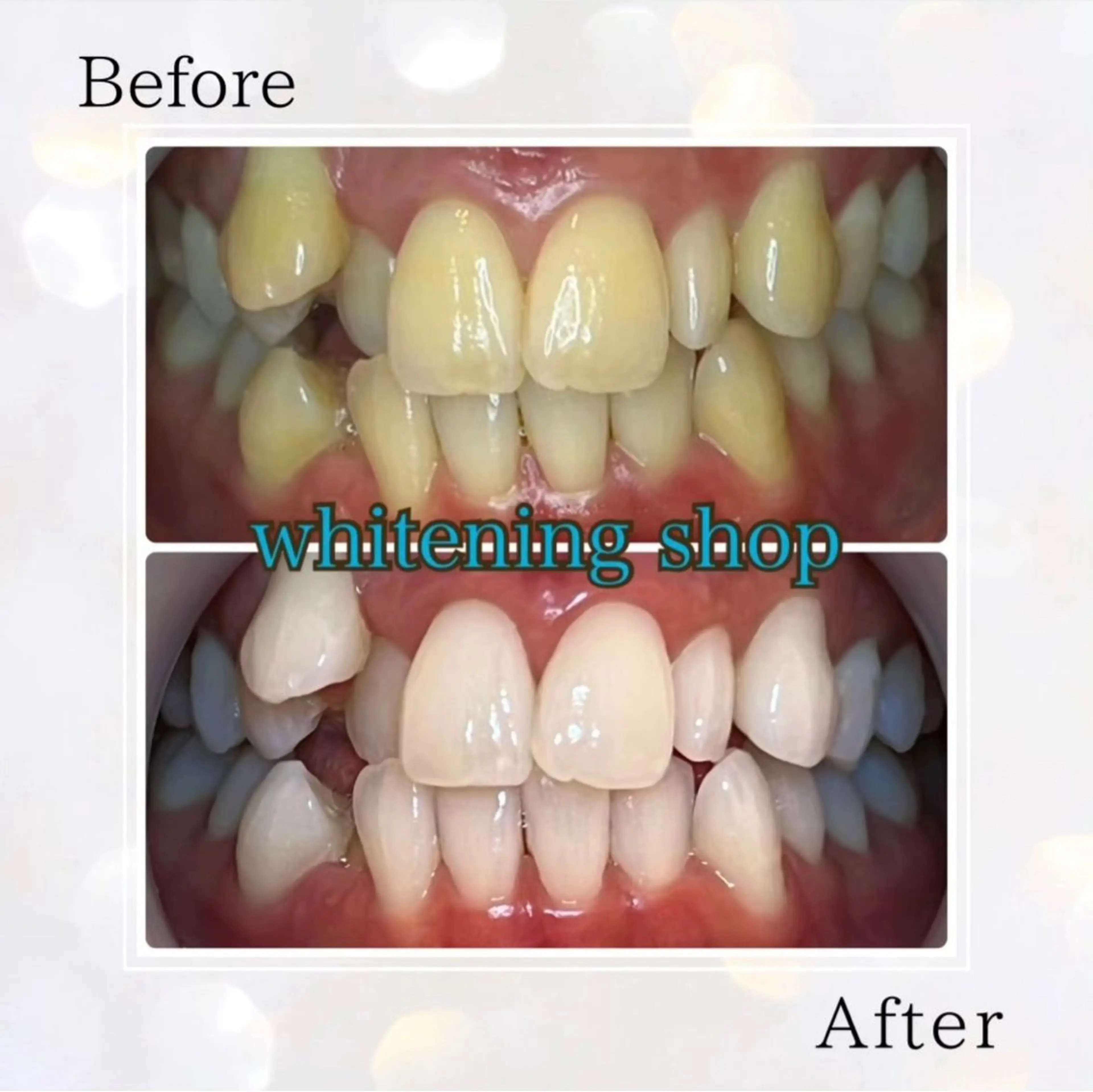 ホワイトニングショップ伊丹店所属・ホワイトニング ショップ伊丹店のその他イメージ