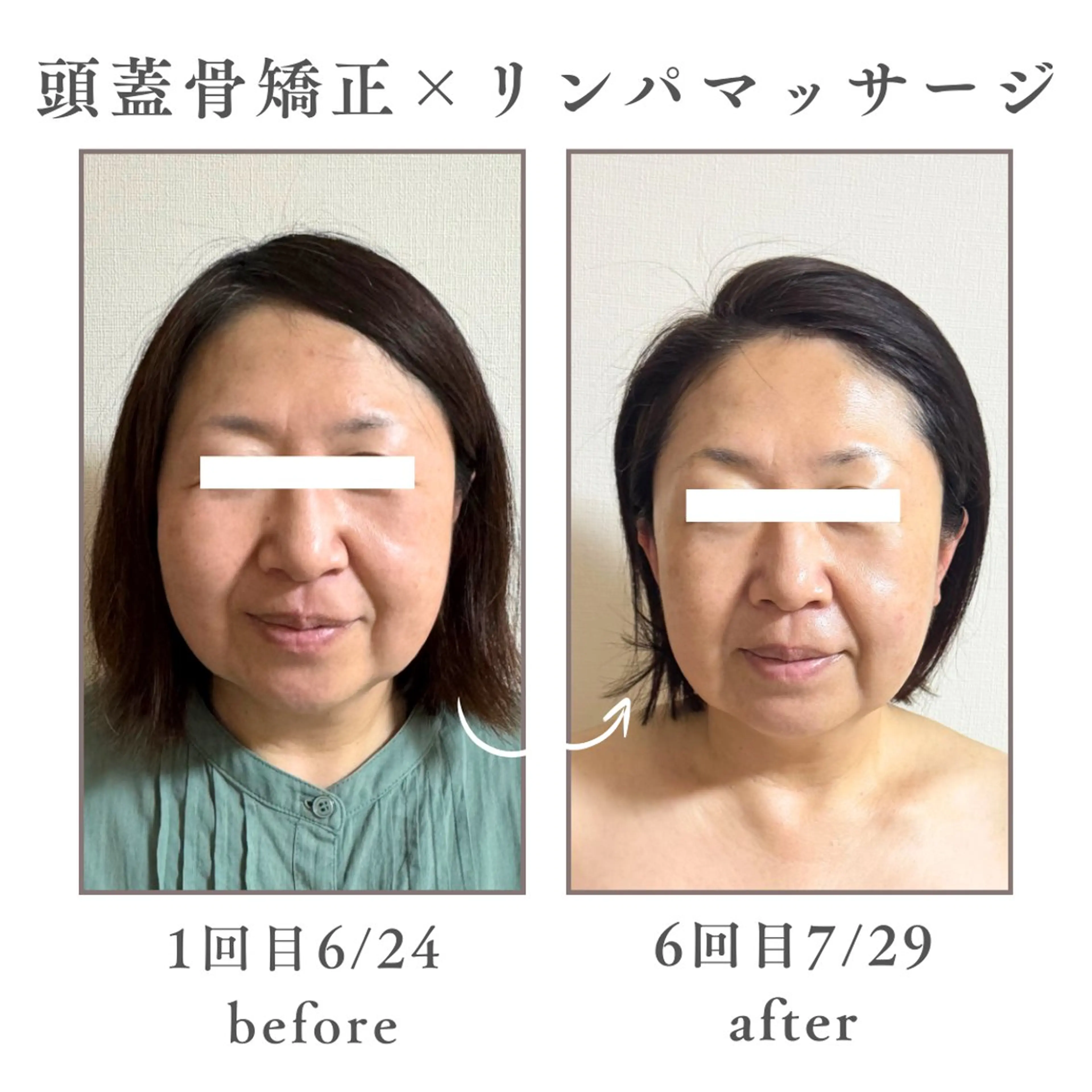 Mignon Lulu🎀のエステ・リラクイメージ