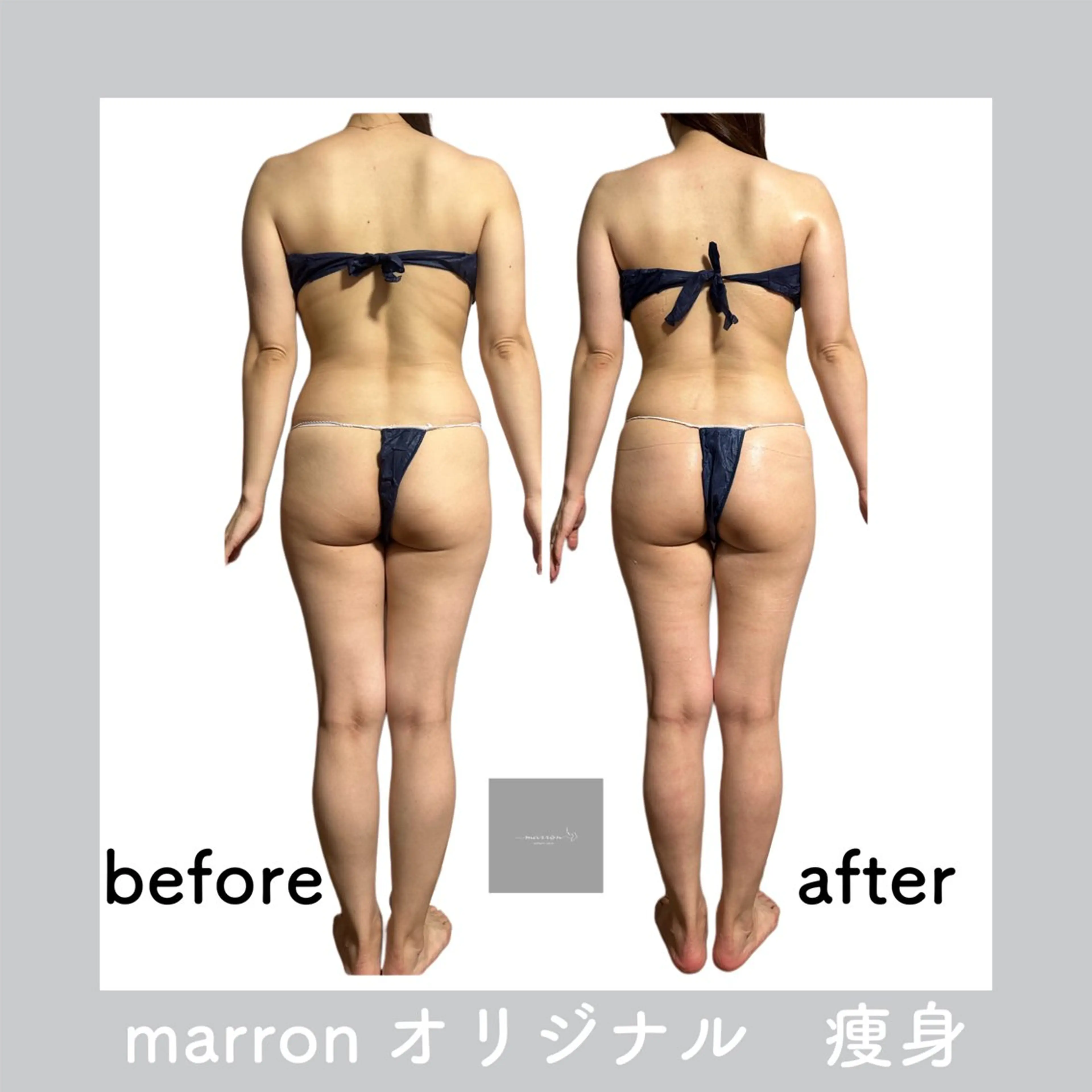 marron所属・痩身ハイパーナイフ ララピールリアボーテのエステ・リラクイメージ