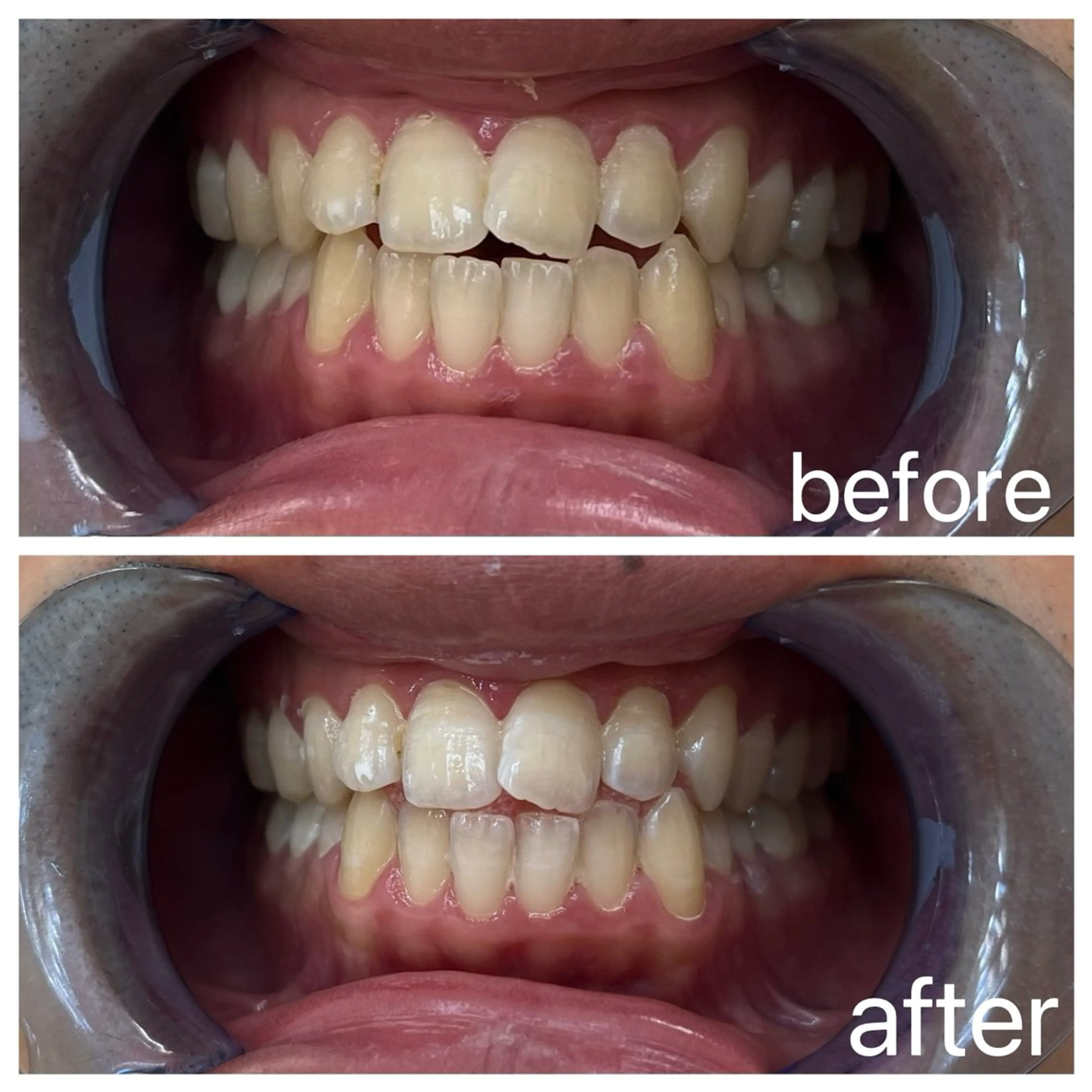 セルフホワイトニングエクシア小山店所属・セルフホワイトニング エクシア小山店のその他イメージ