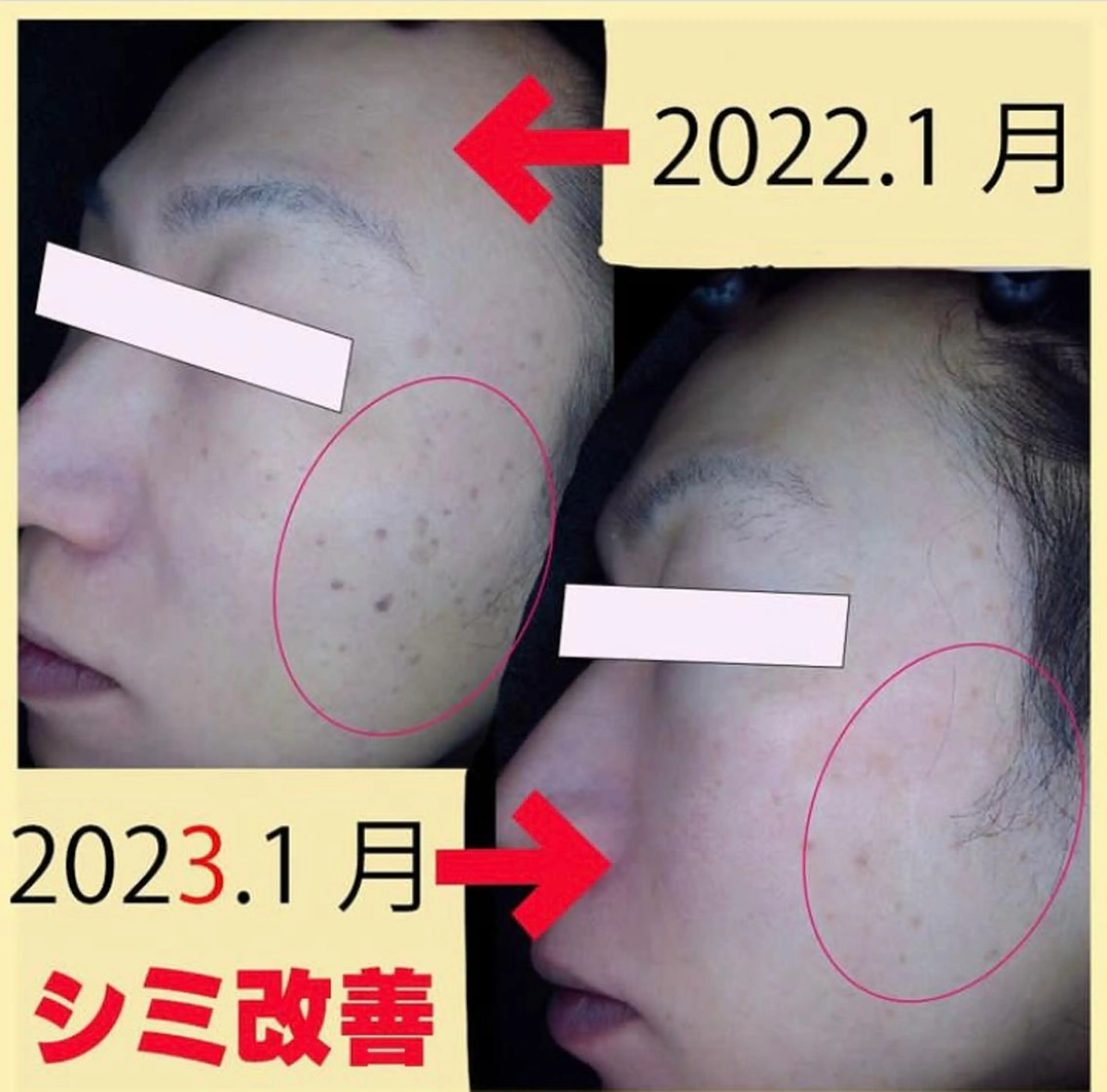 中井 日出子のマツエク・マツパデザイン