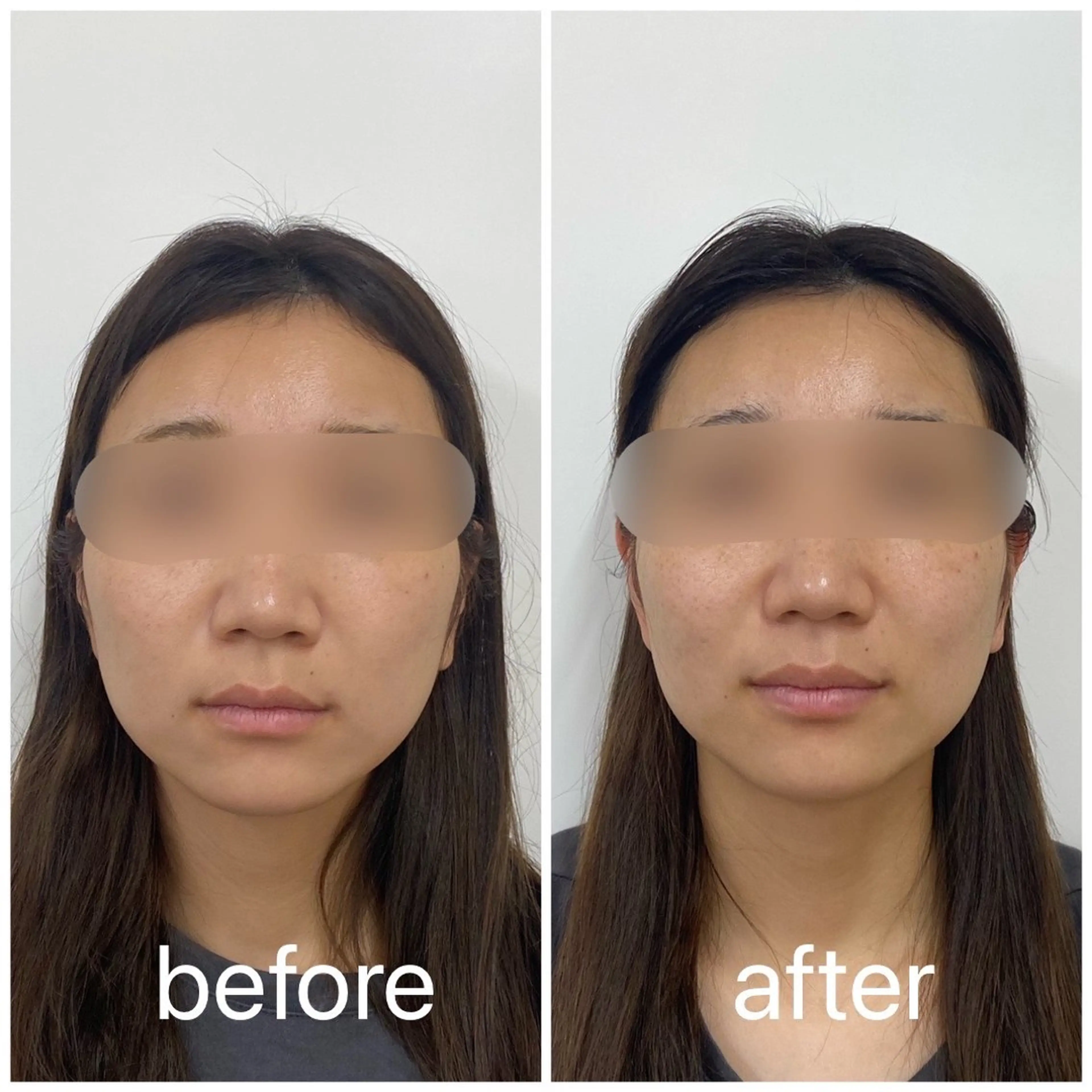 小顔矯正サロンLily所属・小顔矯正サロン Lilyのエステ・リラクイメージ