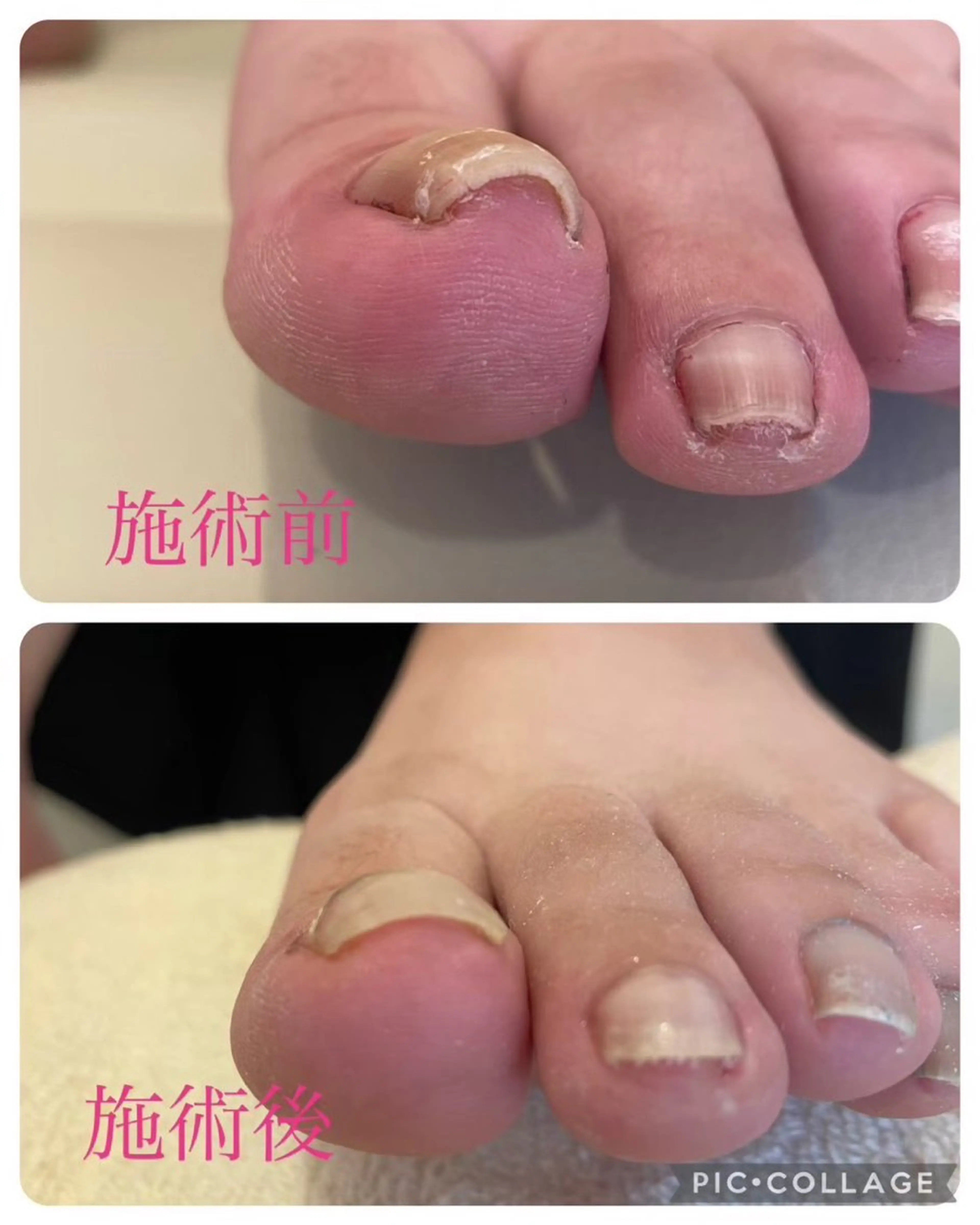 EYELASH SARONるみえーるのマツエク・マツパデザイン