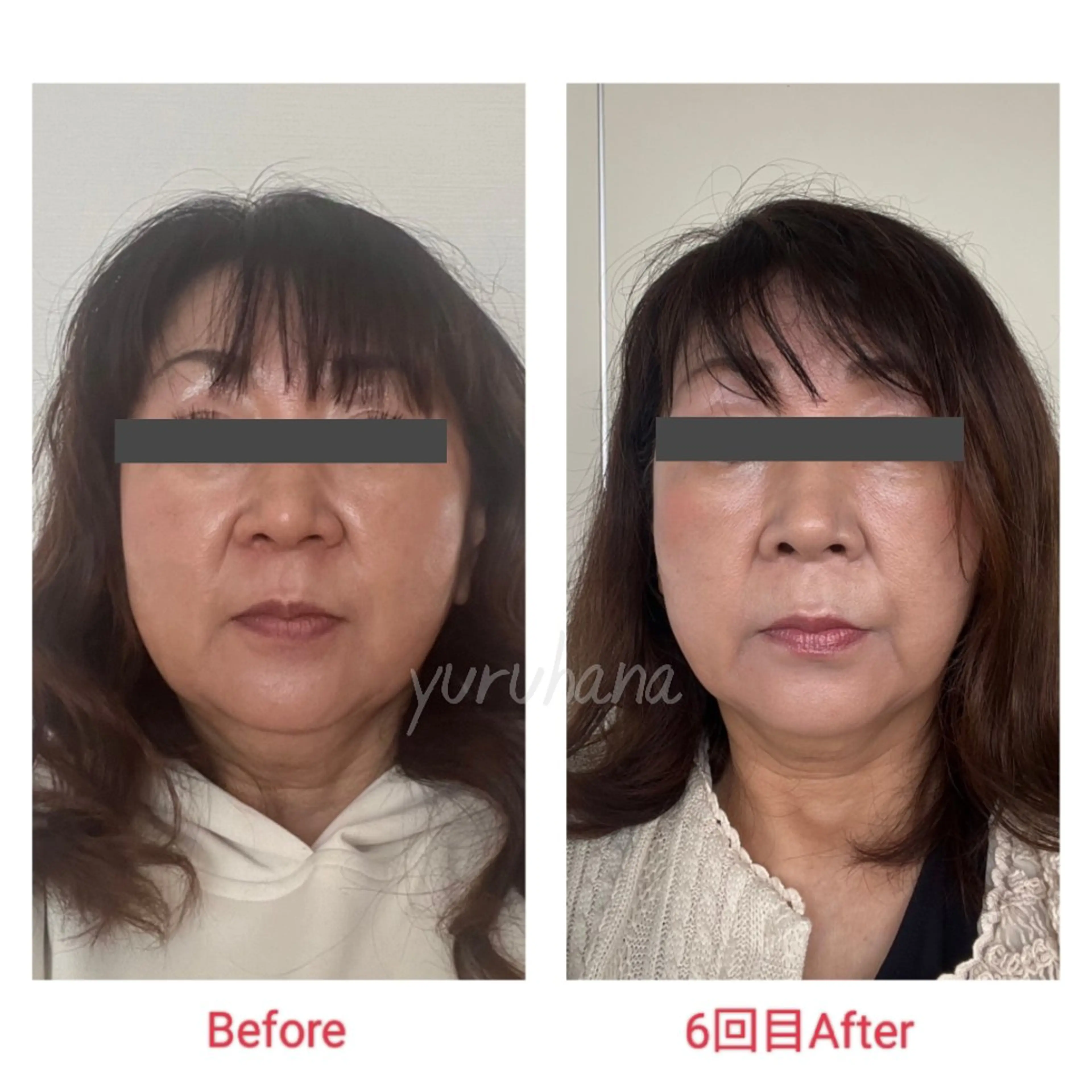 自然療法足つぼサロン yuruhanaのエステ・リラクイメージ