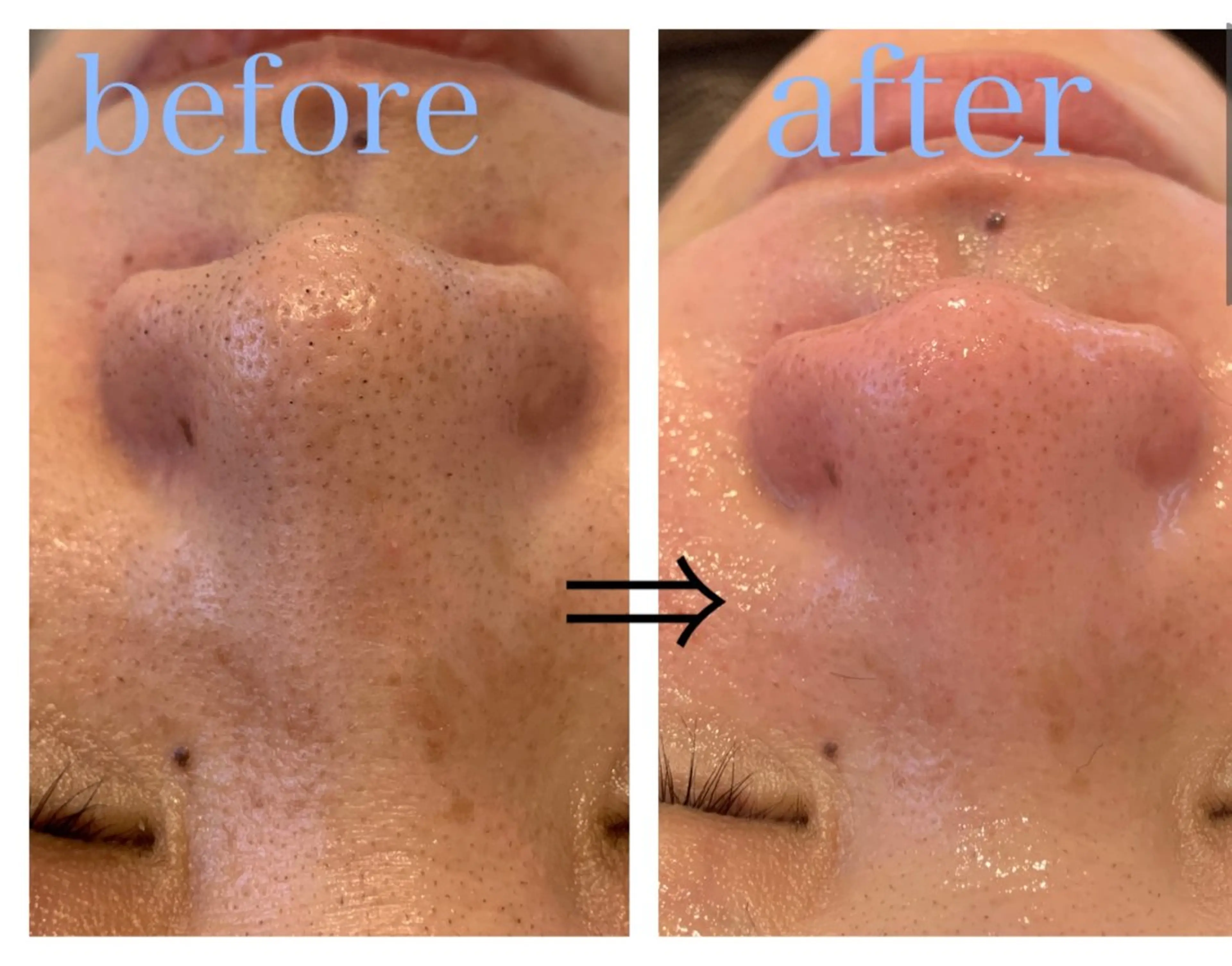 リジュベ所属・Rejuve ﾘｼﾞｭﾍﾞのエステ・リラクイメージ