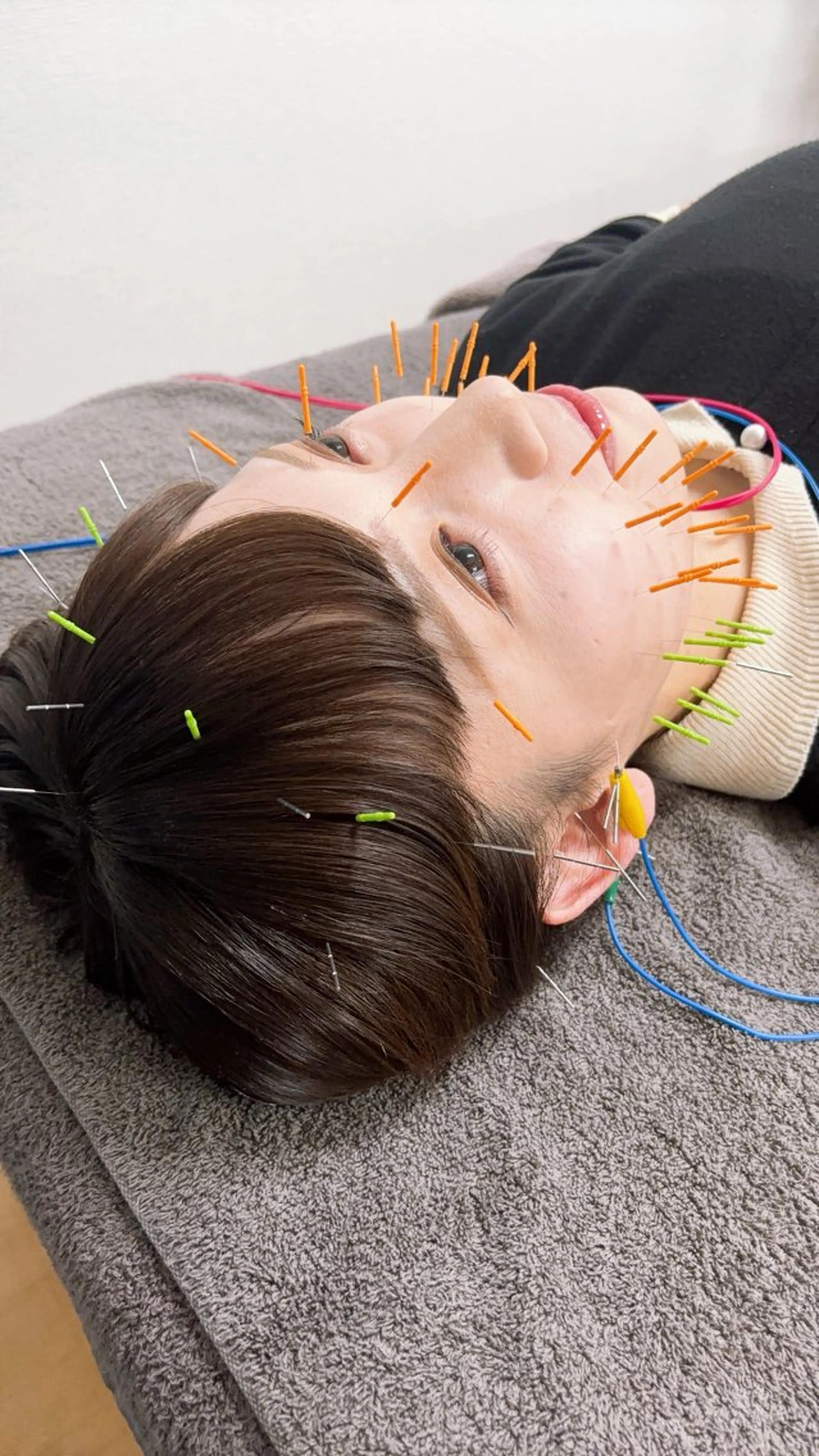 美容鍼・小顔矯正 ハリシェンドのエステ・リラクイメージ