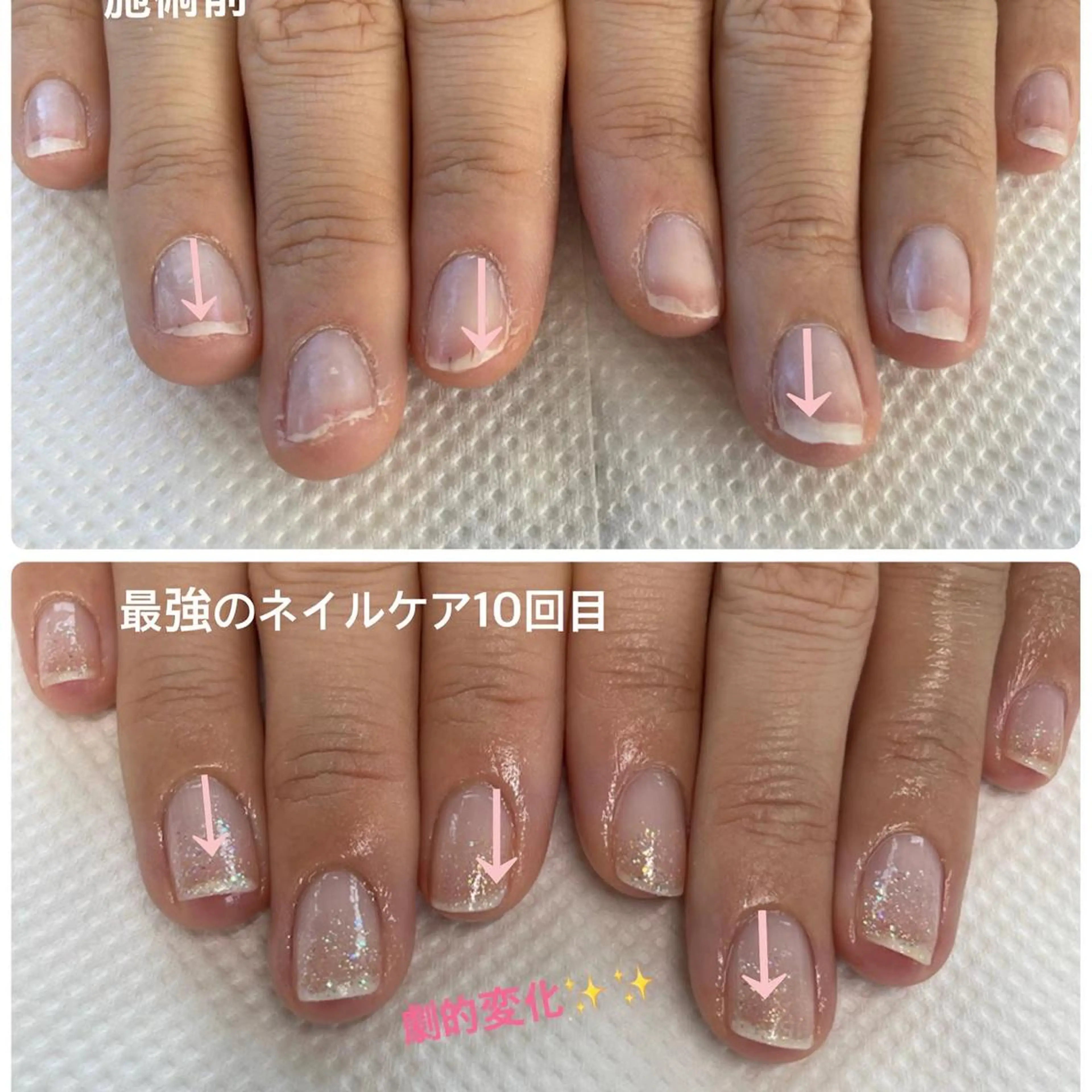 ✨最強の自爪育成ネイルケア💅お試し１回✨ご自身のお爪を美爪にしたいけど続けられるか不安な方✨1回でも変化します❣️の写真