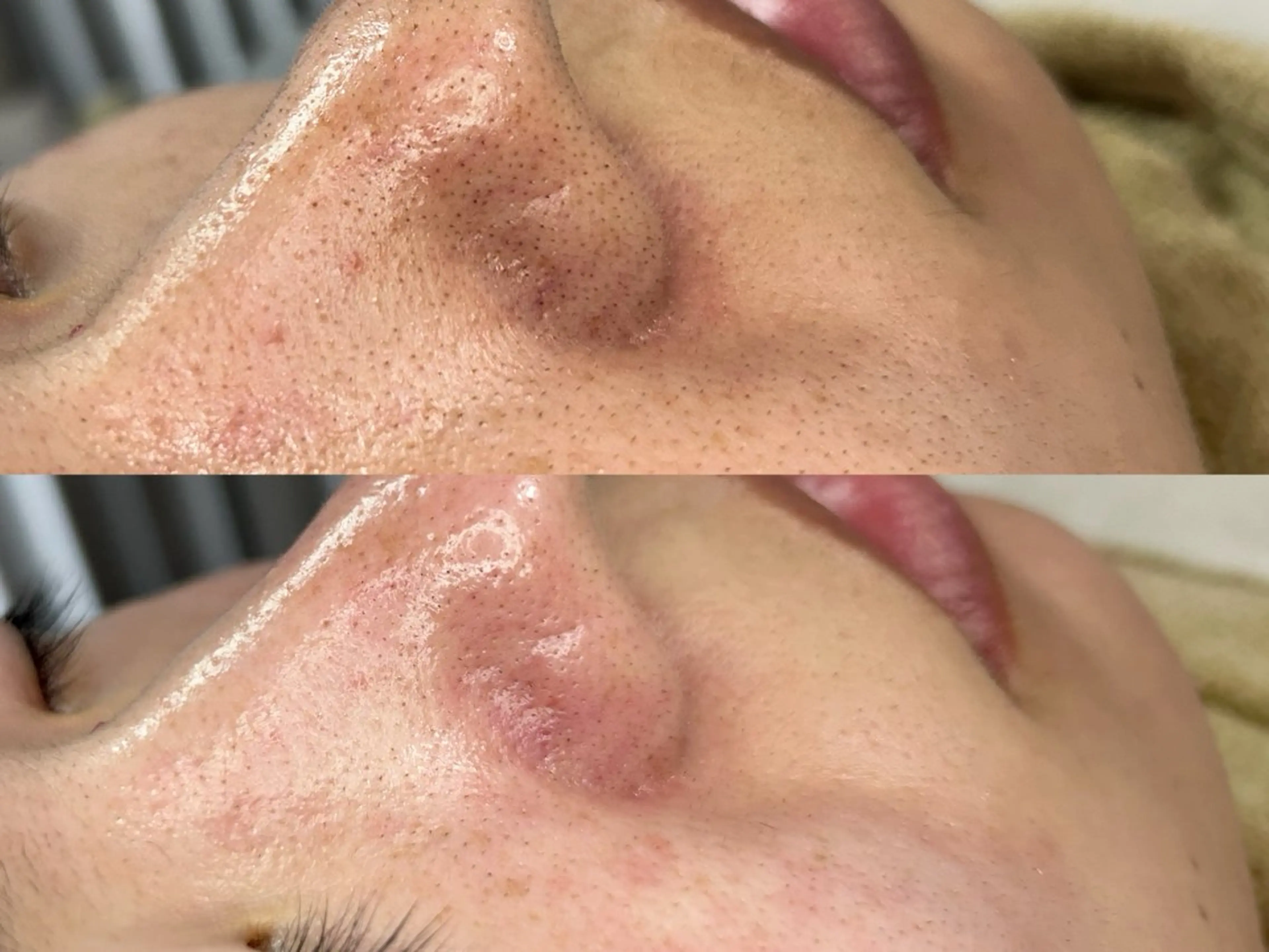 美肌脱毛&毛穴専門 Nico🐰ྀི♡のエステ・リラクイメージ