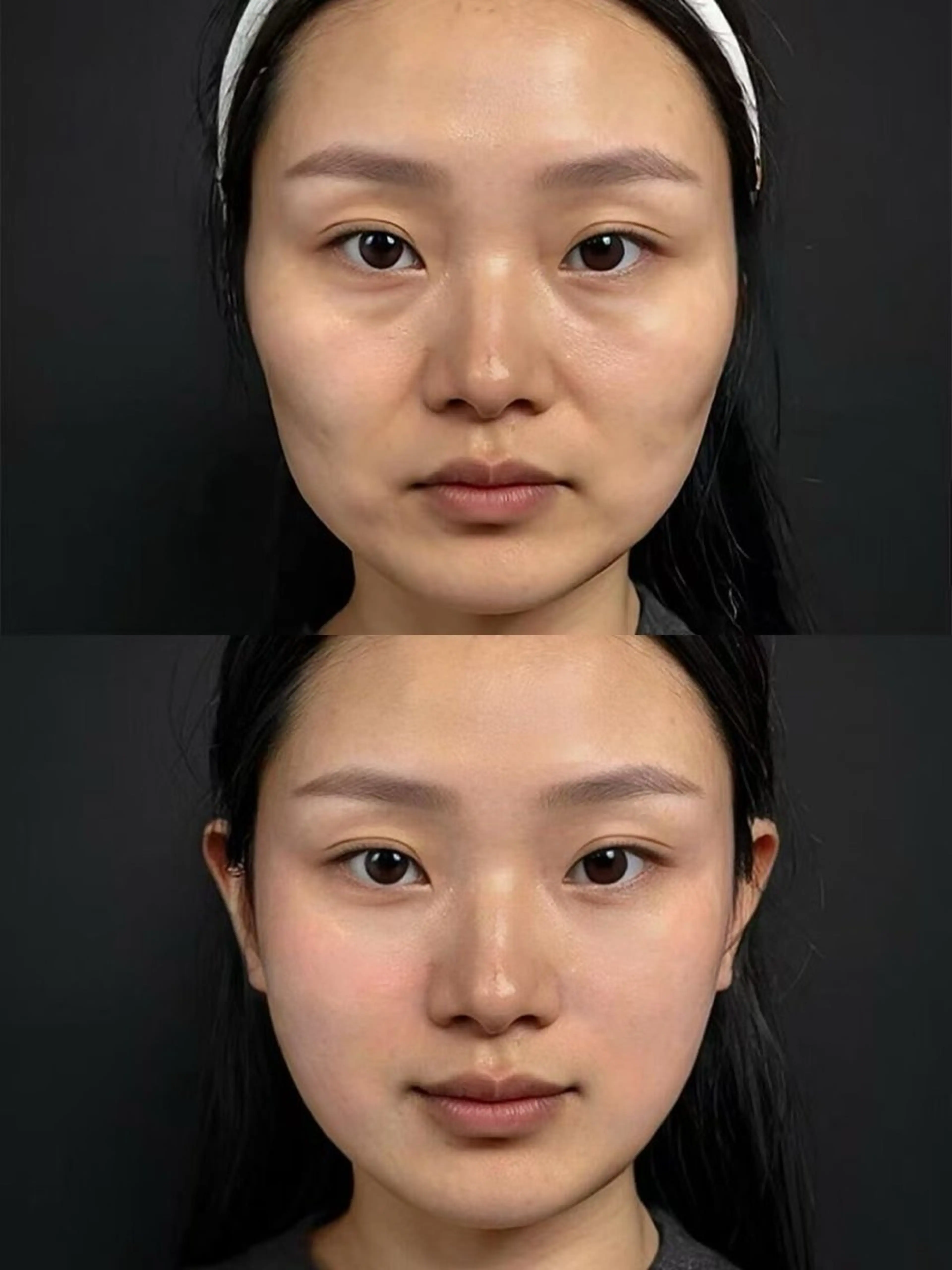 ネイル エステ aliaハイフ&水光ジェットサロン所属・aliaハーブ水光店 エステティシャン募集のエステ・リラクイメージ