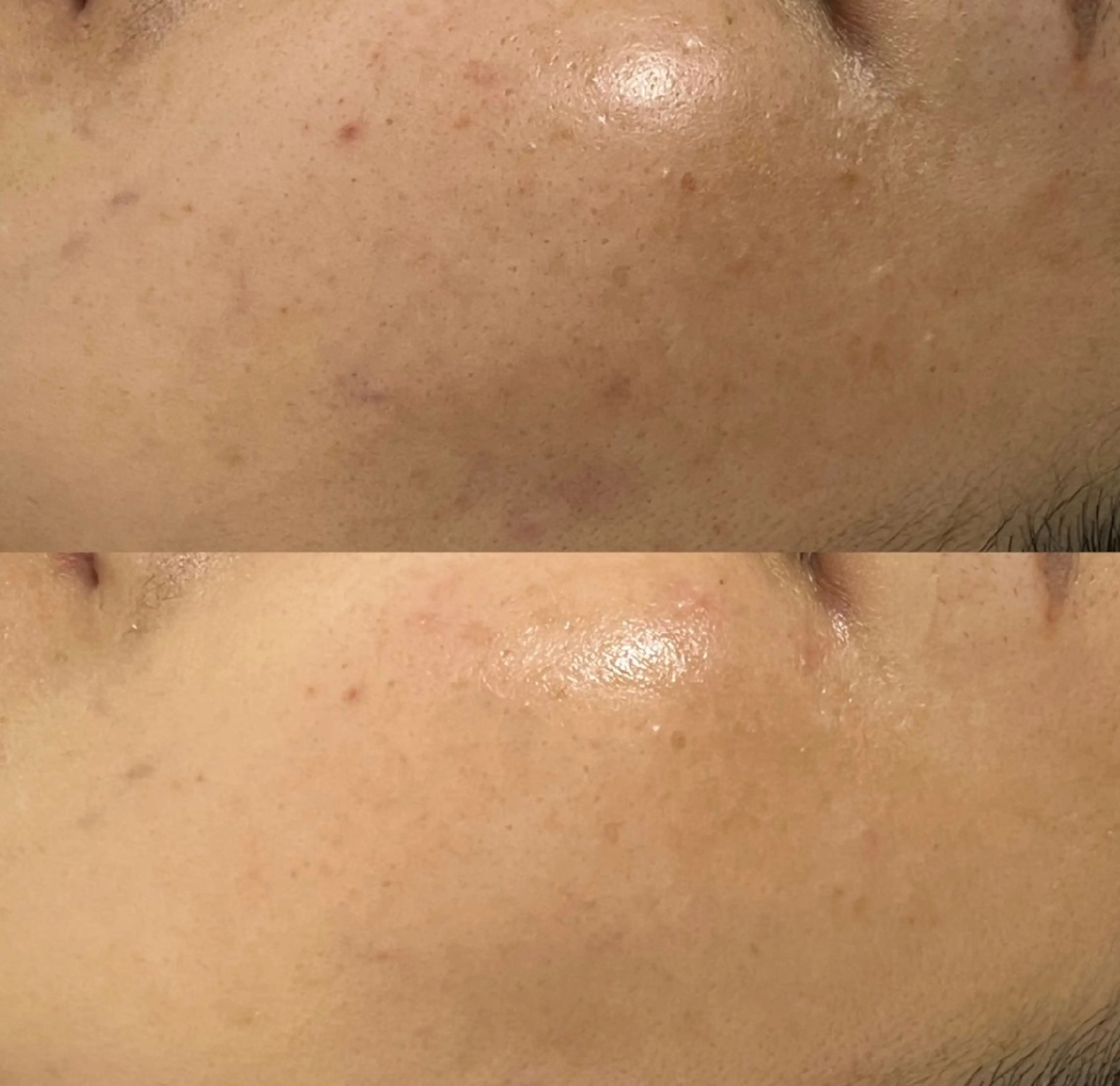 エステ Charis エステ&ネイルのエステ・リラクイメージ