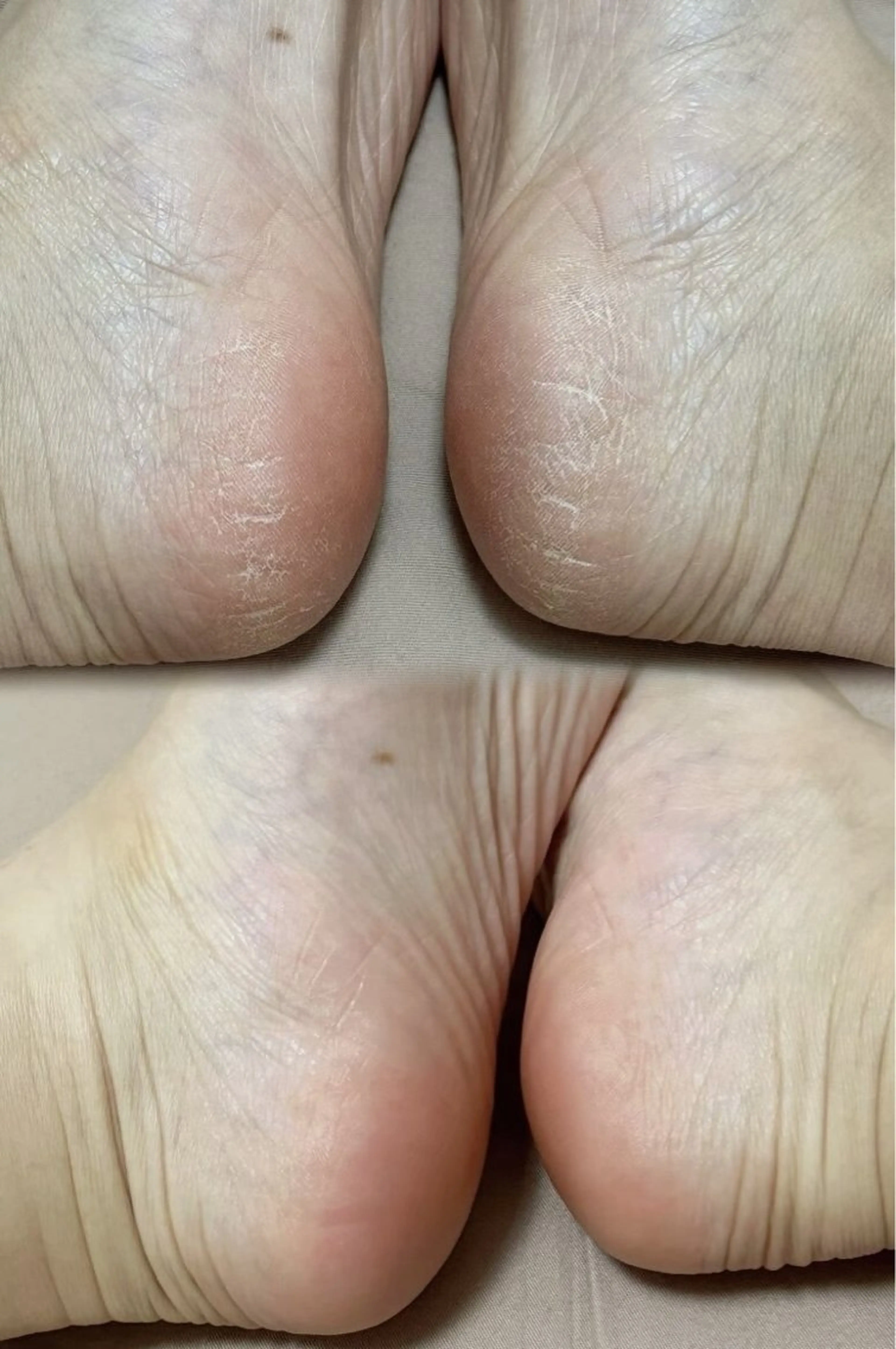 【フット】角質除去♪つるんつるんケア¥4500→4000の写真