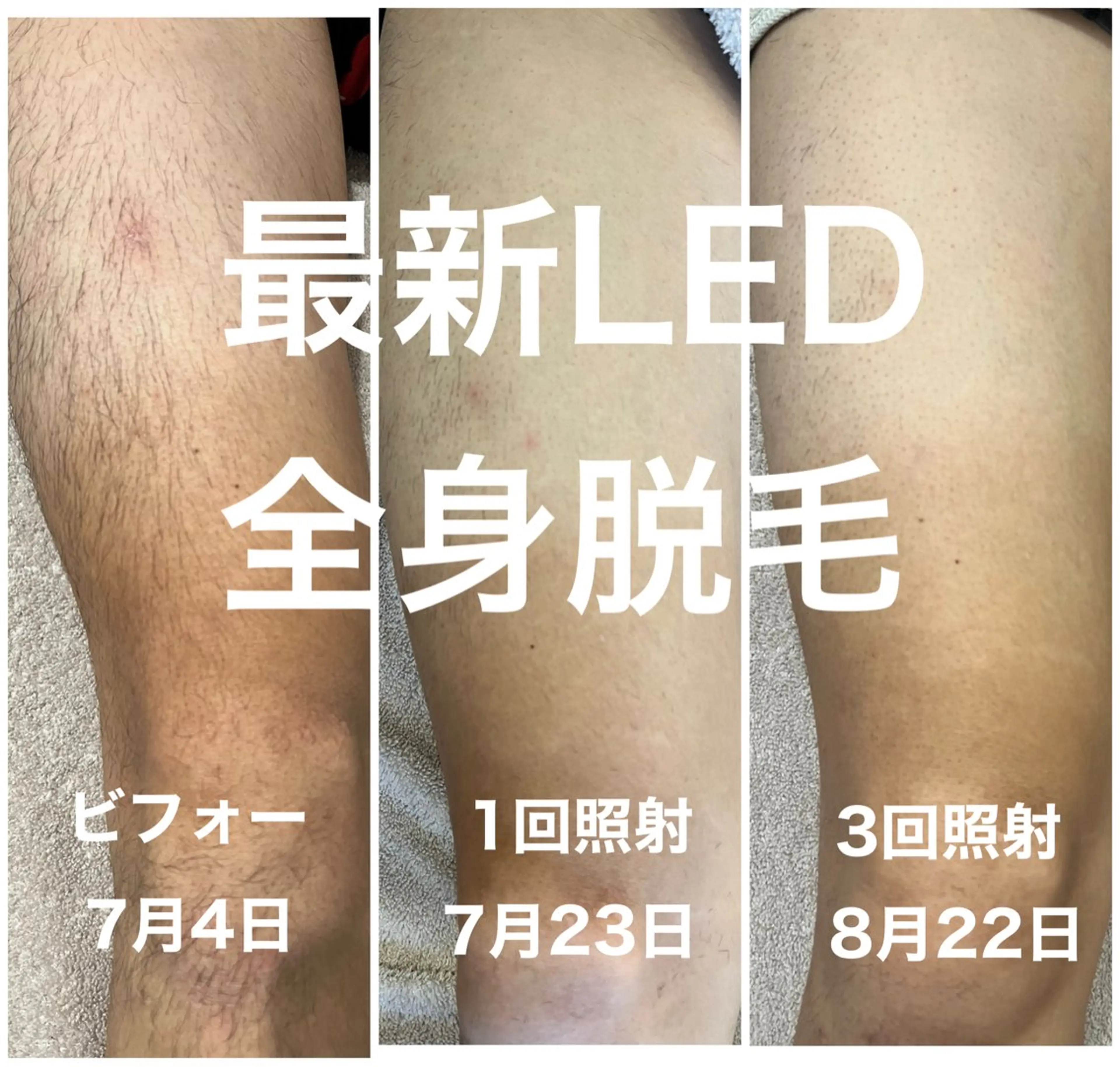 脱毛 楠田 万利子のマツエク・マツパデザイン