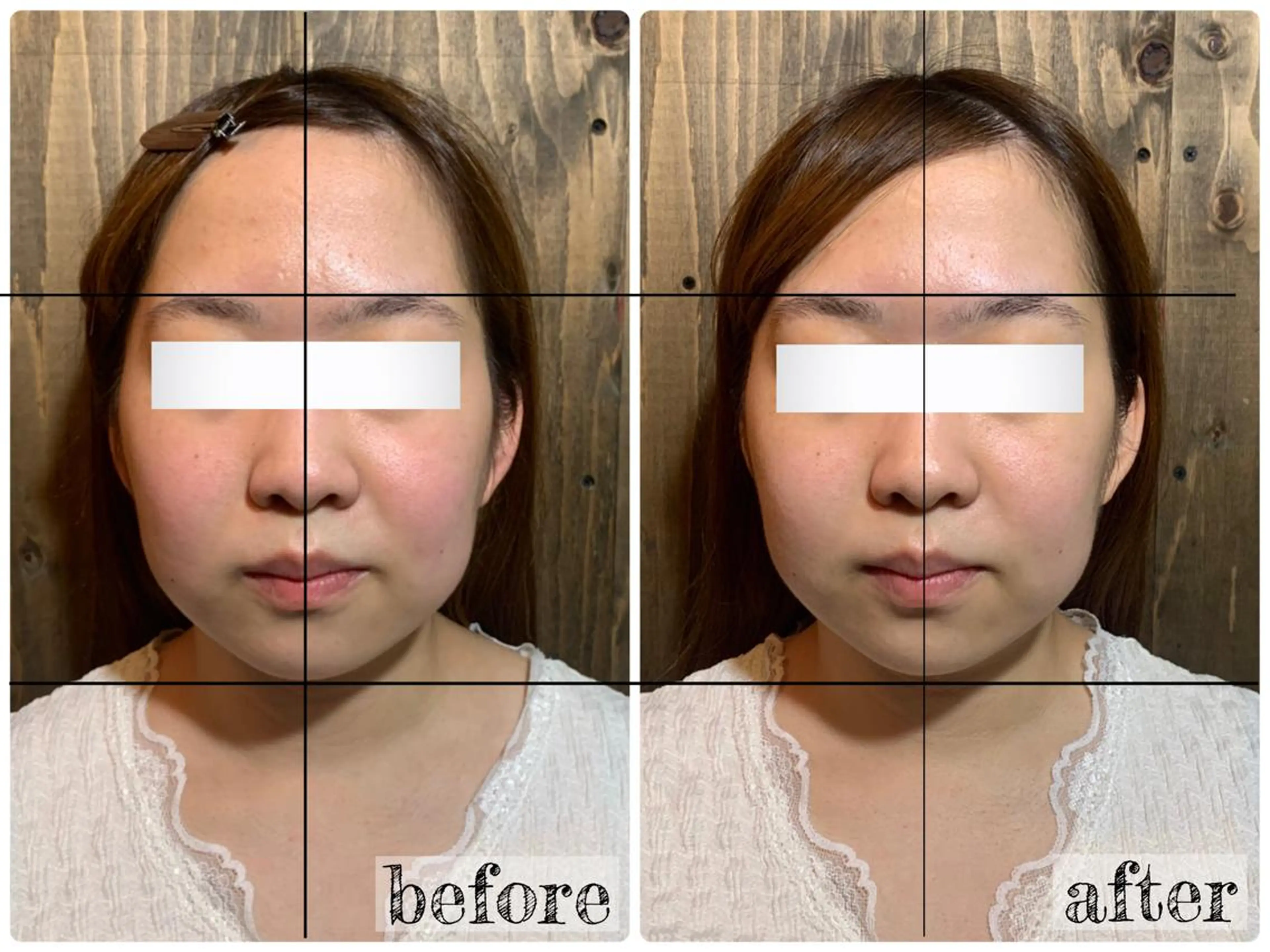 エステ リラク 💎後悔させない小顔 矯正💎イトヤマ🌱のエステ・リラクイメージ