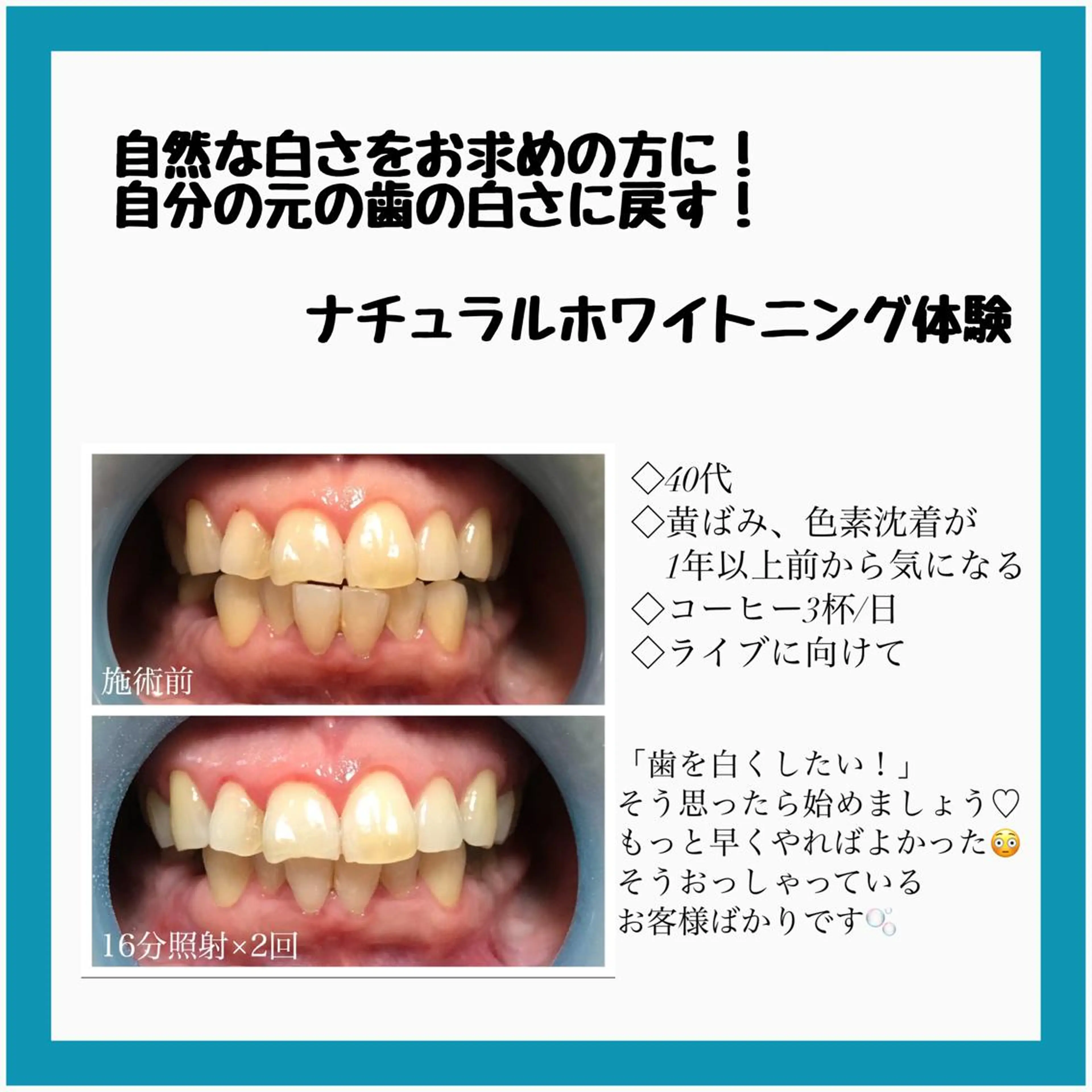 ネイル/耳つぼ /新ホワイトニングのネイルデザイン