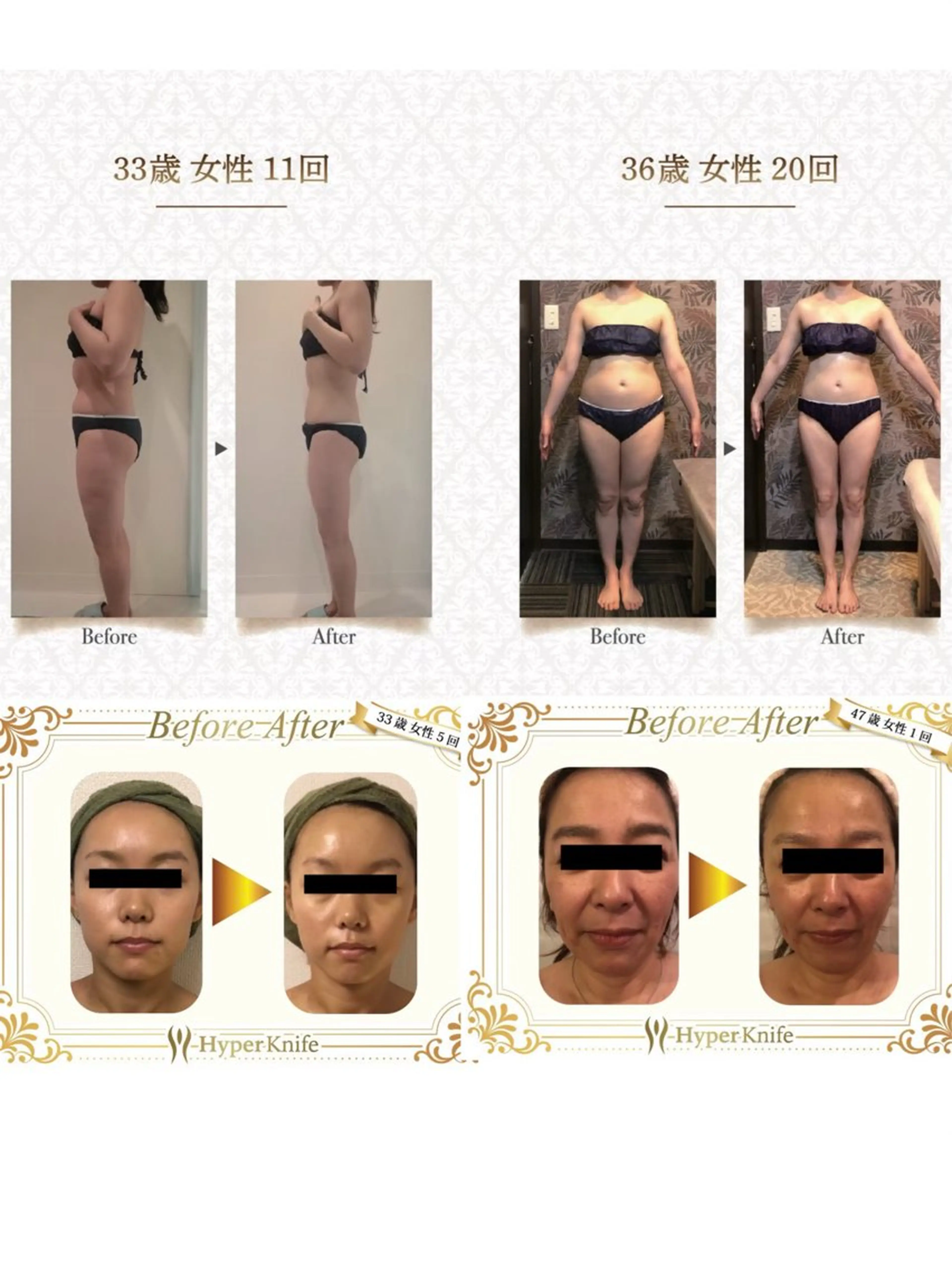 美癒 ハイパーナイフ&アロマ所属・美癒 池袋東口店のエステ・リラクイメージ