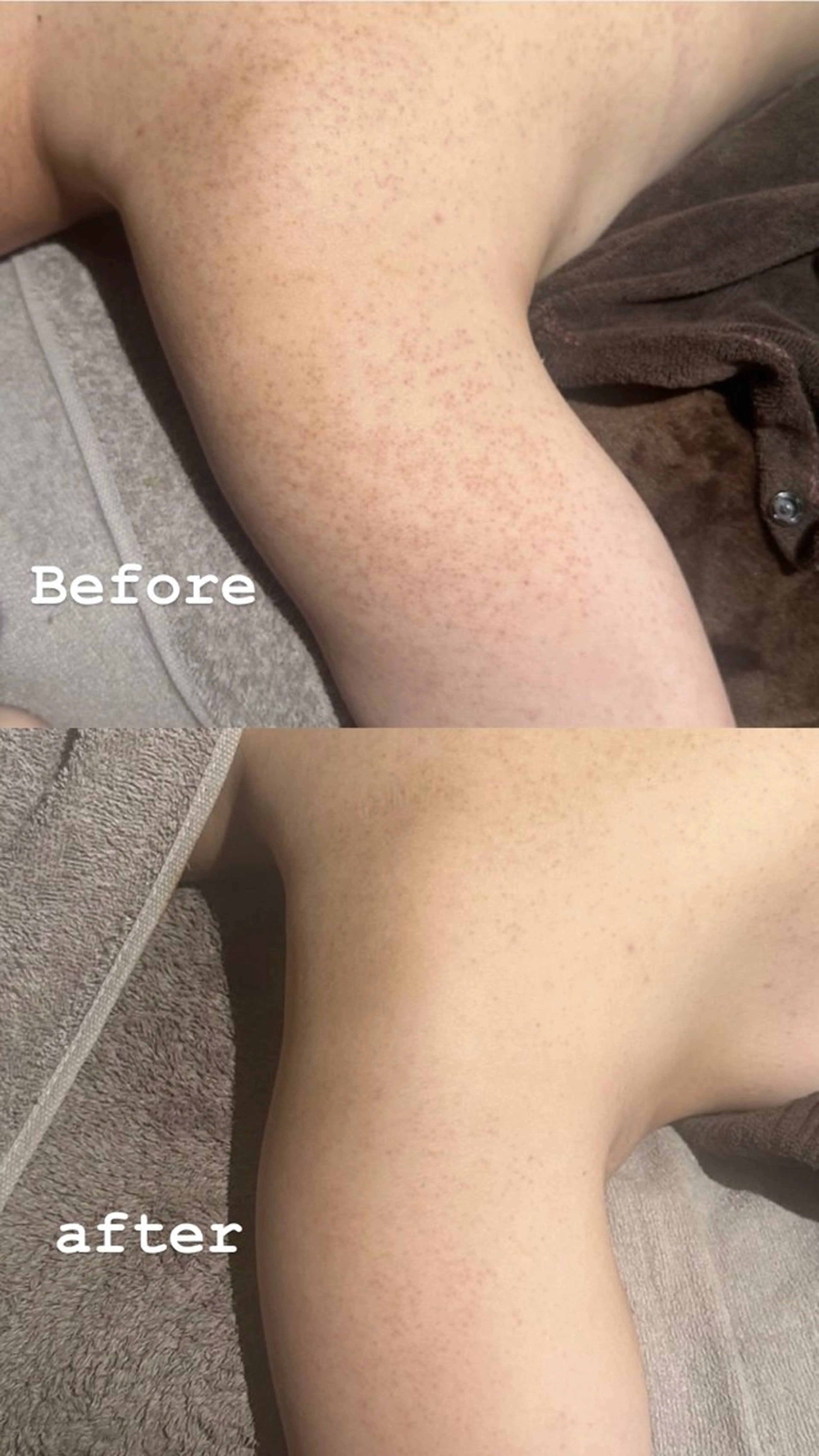 エミルカ 自由が丘店所属・ニキビ改善ハーブ🌿 ハナシマのその他イメージ